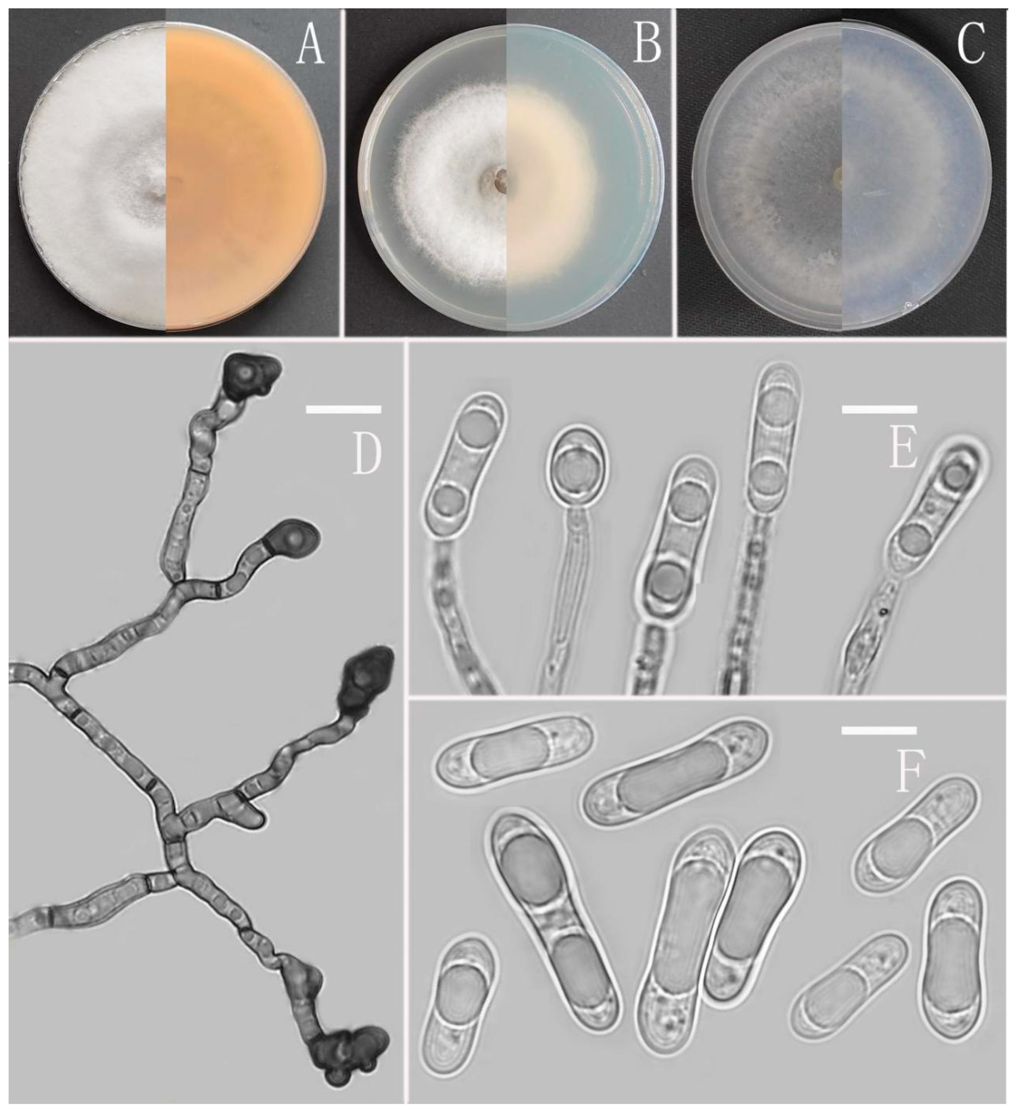 Jof 08 00185 g014 Jof 08 00185 g014