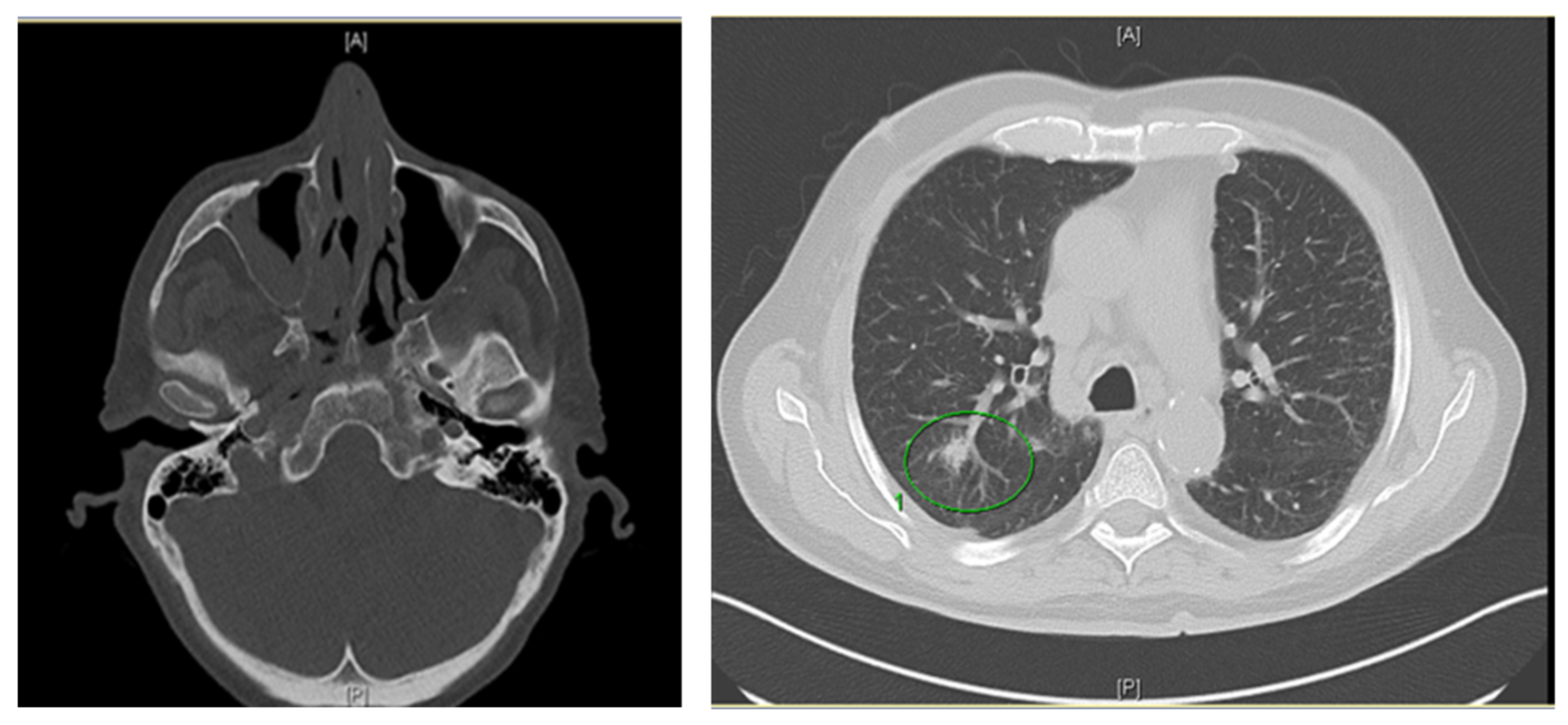 Jof 08 00306 g001 Jof 08 00306 g001