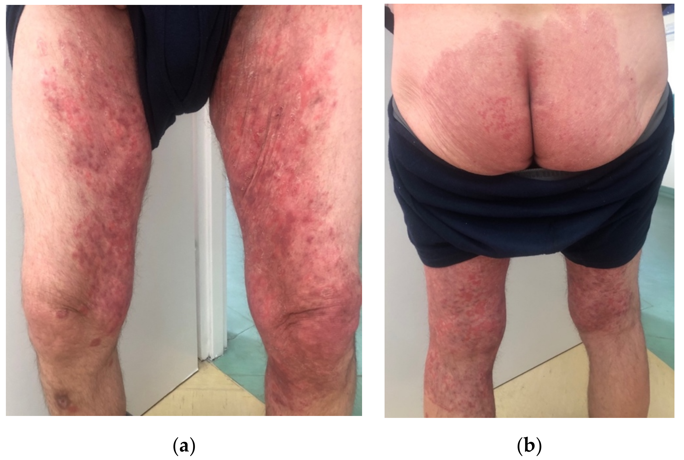 Jof 08 00312 g001 550