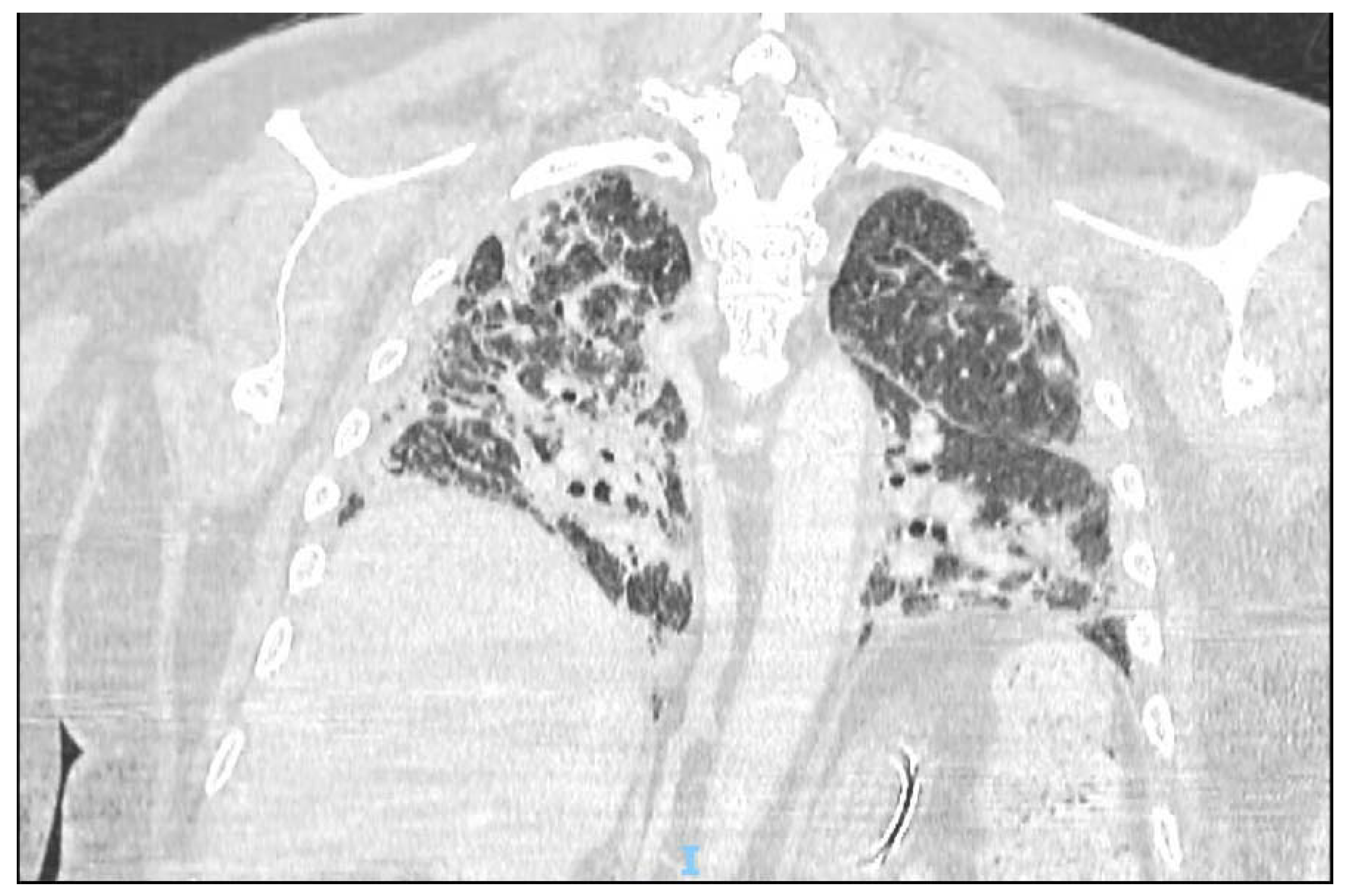 Jof 08 00415 g001 550