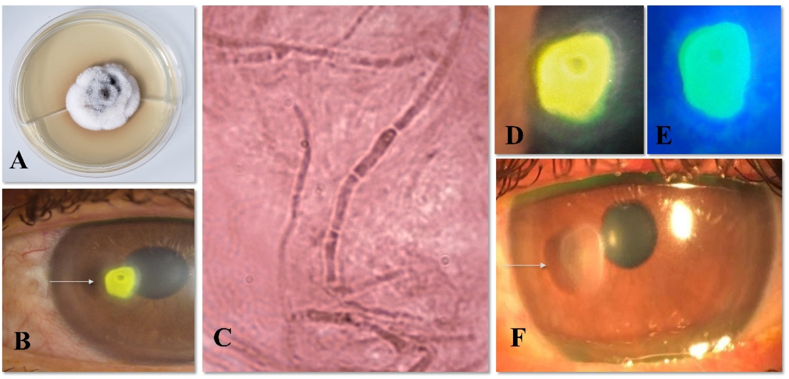 Jof 08 00507 g001 Jof 08 00507 g001