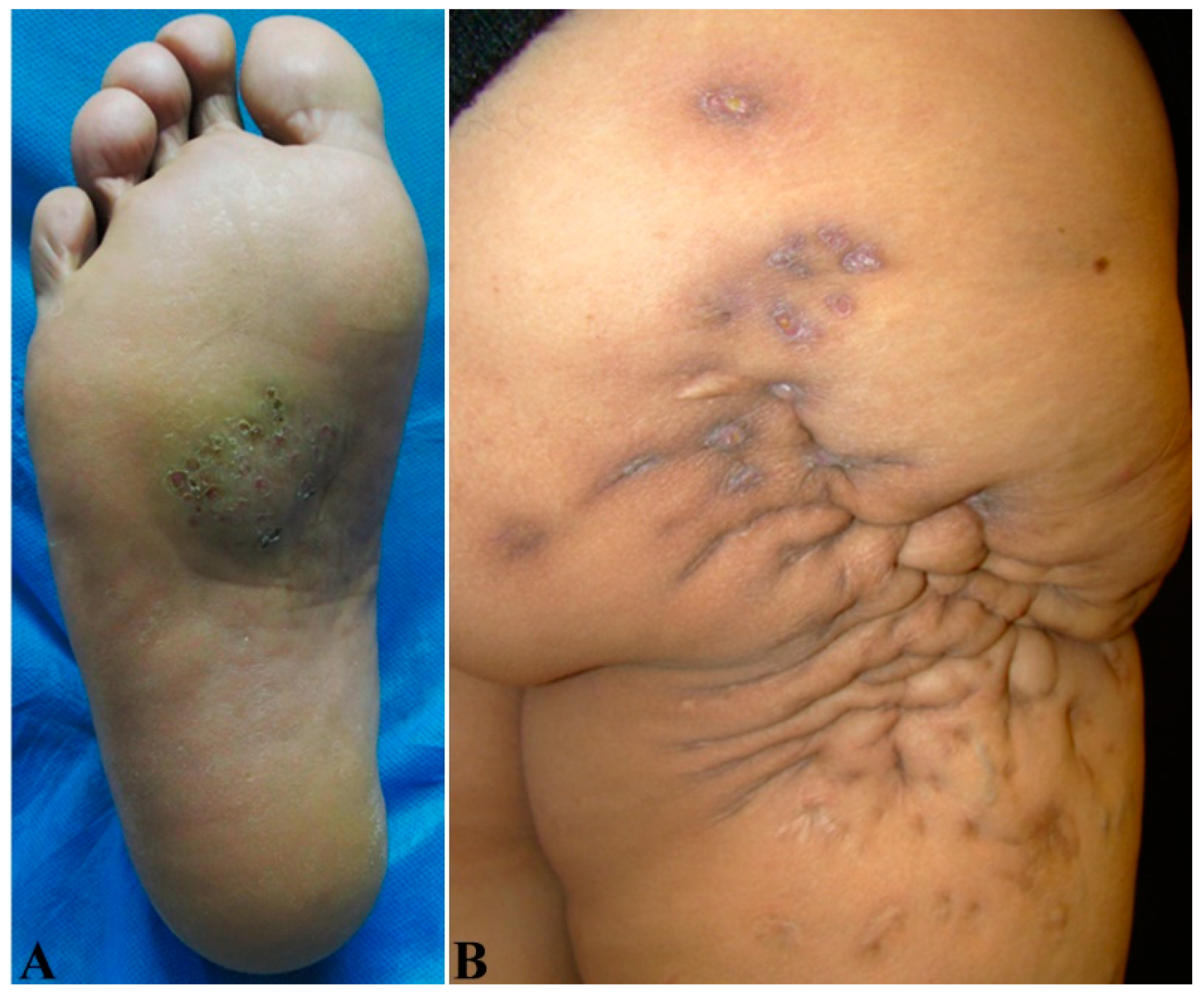 Jof 08 00743 g002 Jof 08 00743 g002