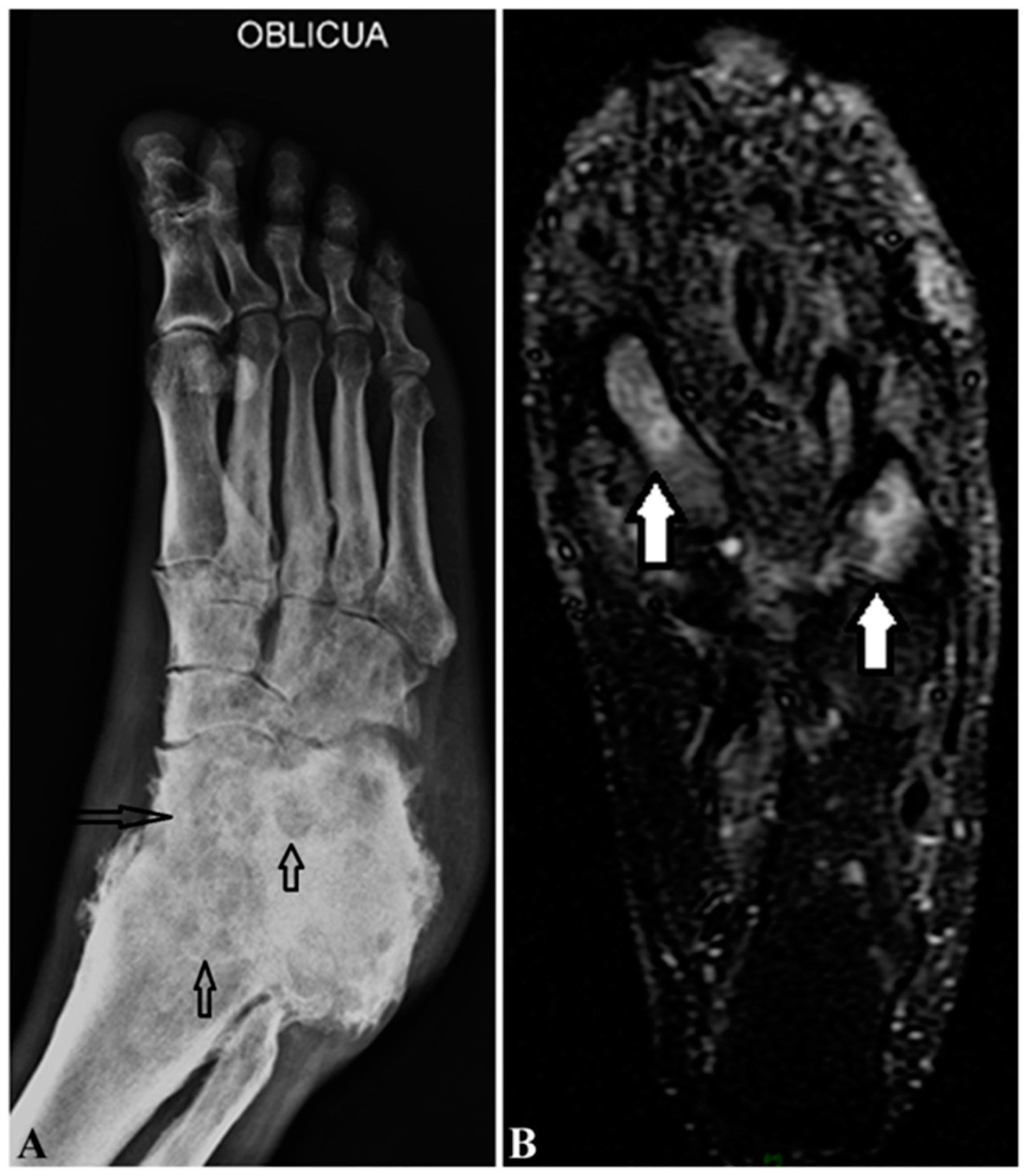 Jof 08 00743 g004 Jof 08 00743 g004