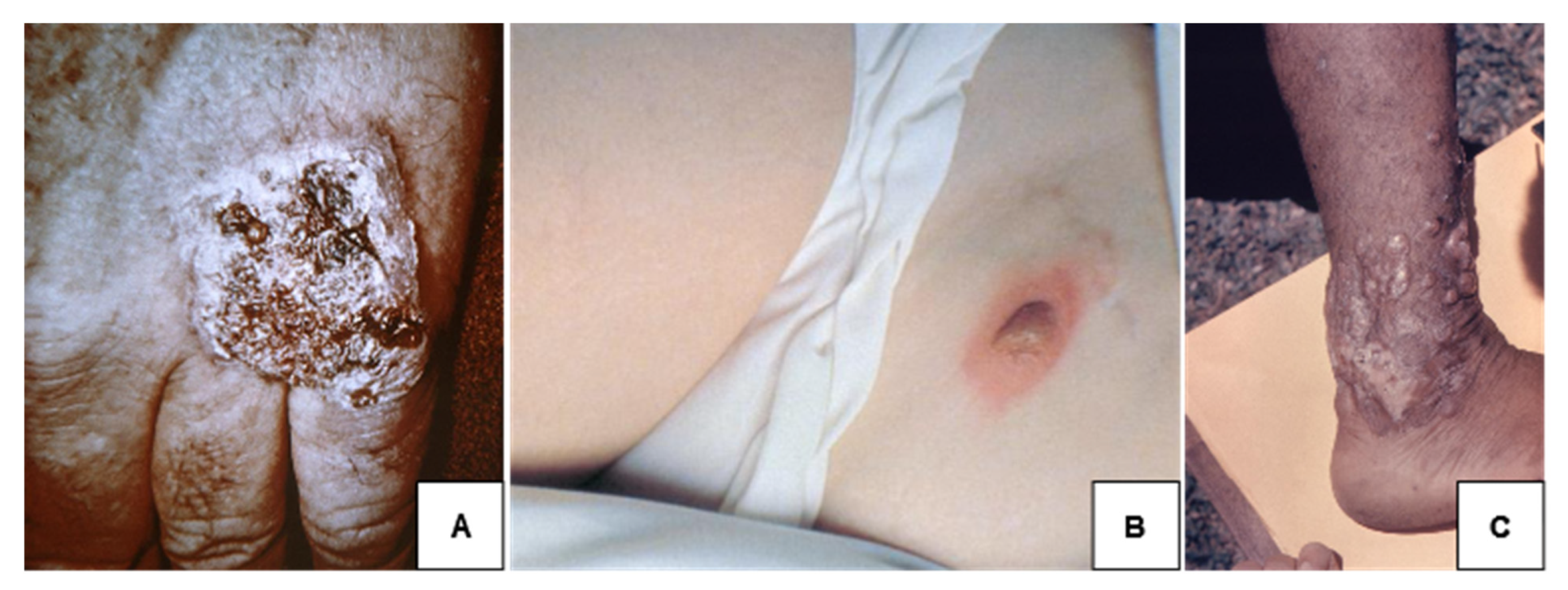 Jof 08 00824 g004 Jof 08 00824 g004