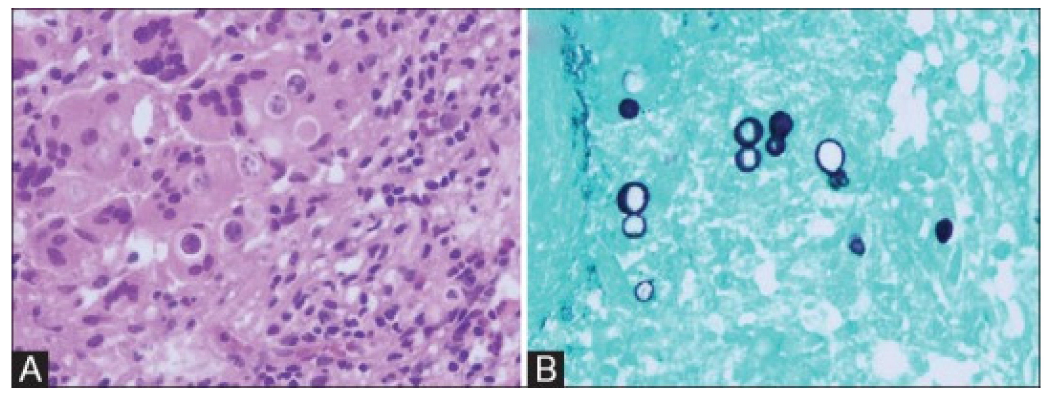 Jof 08 00824 g005 Jof 08 00824 g005