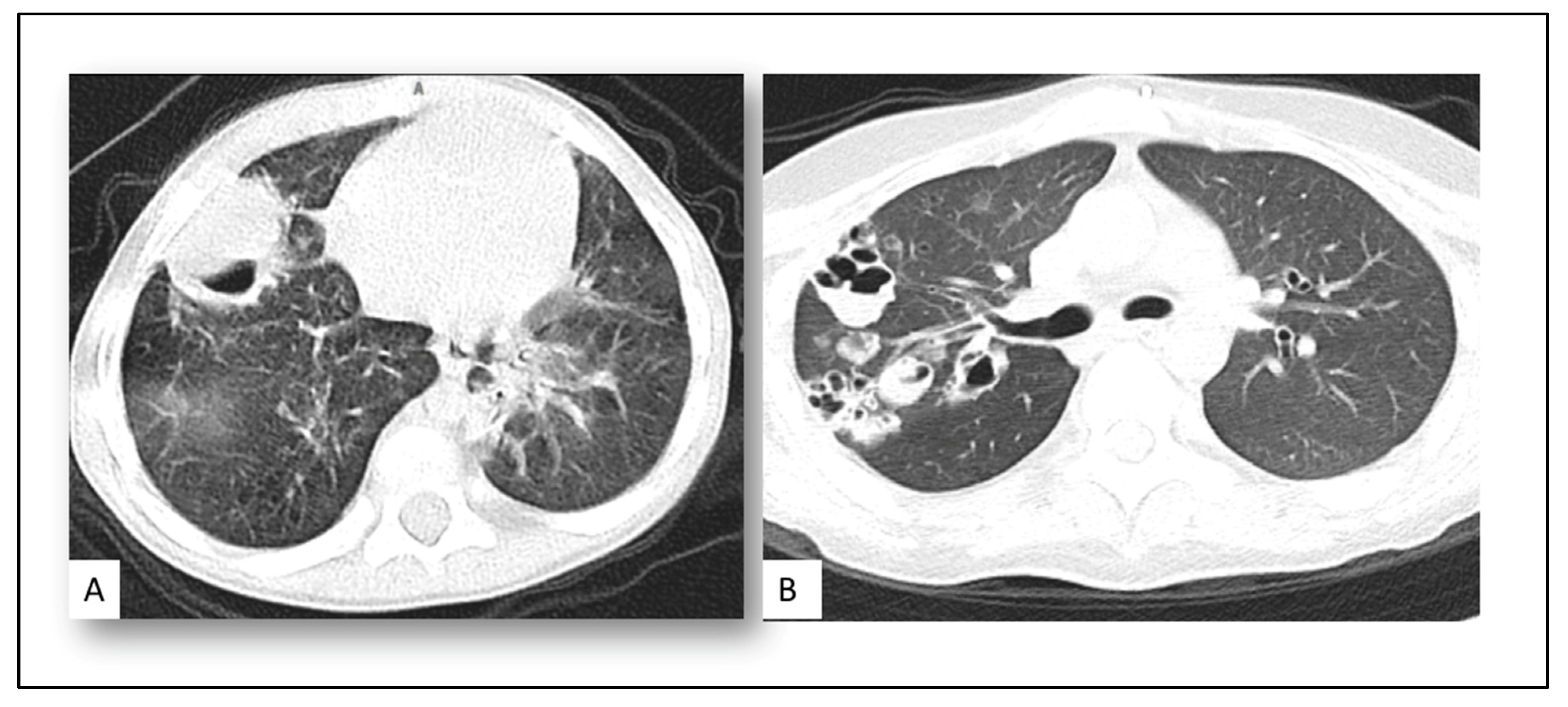 Jof 08 00850 g002 550