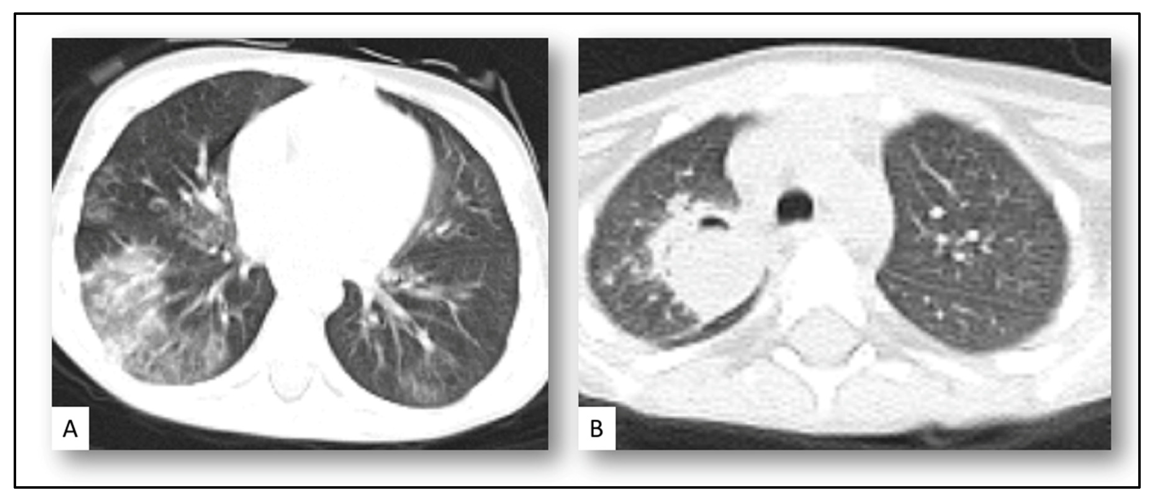 Jof 08 00850 g003 550