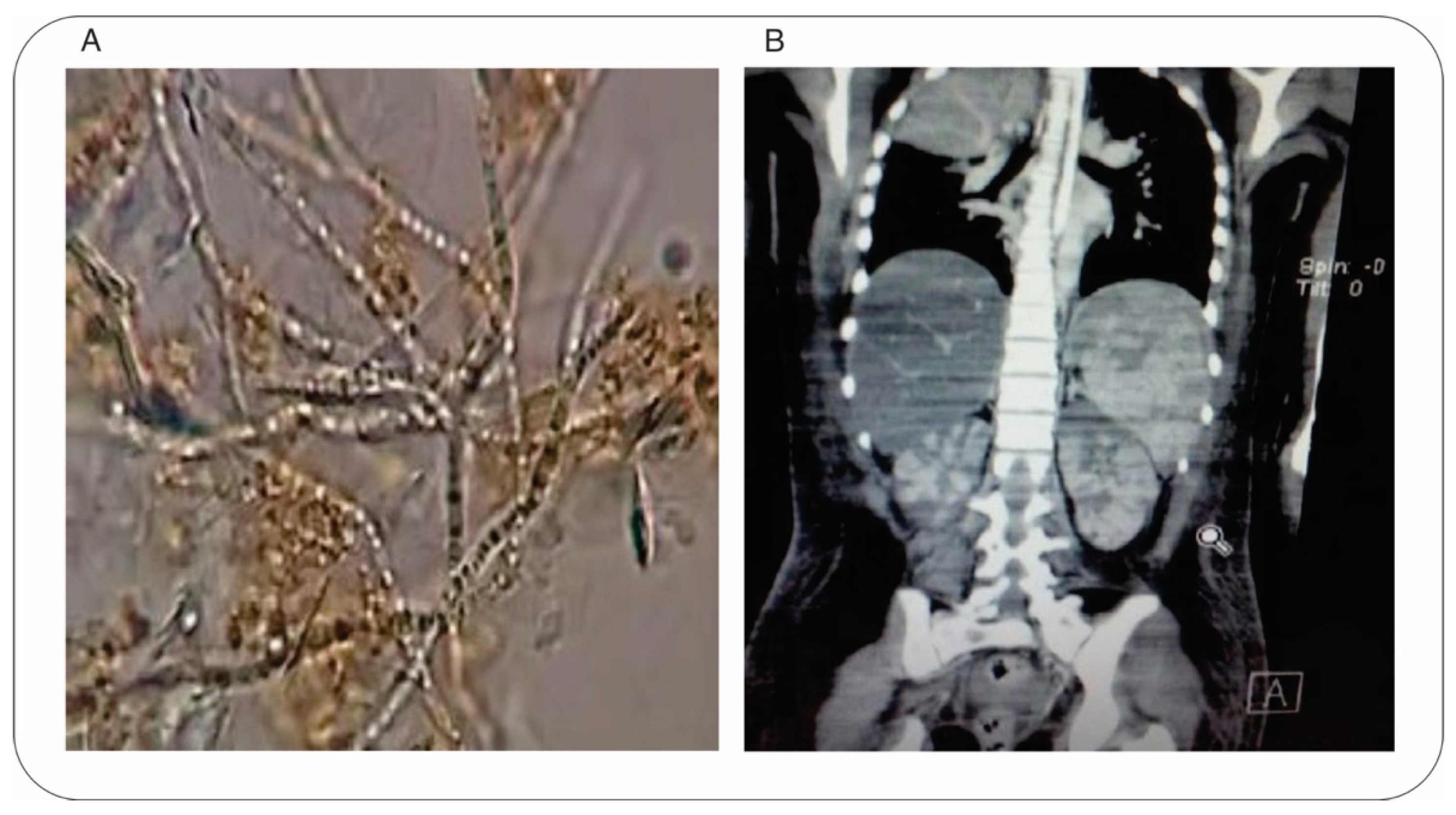 Jof 08 00851 g001 550