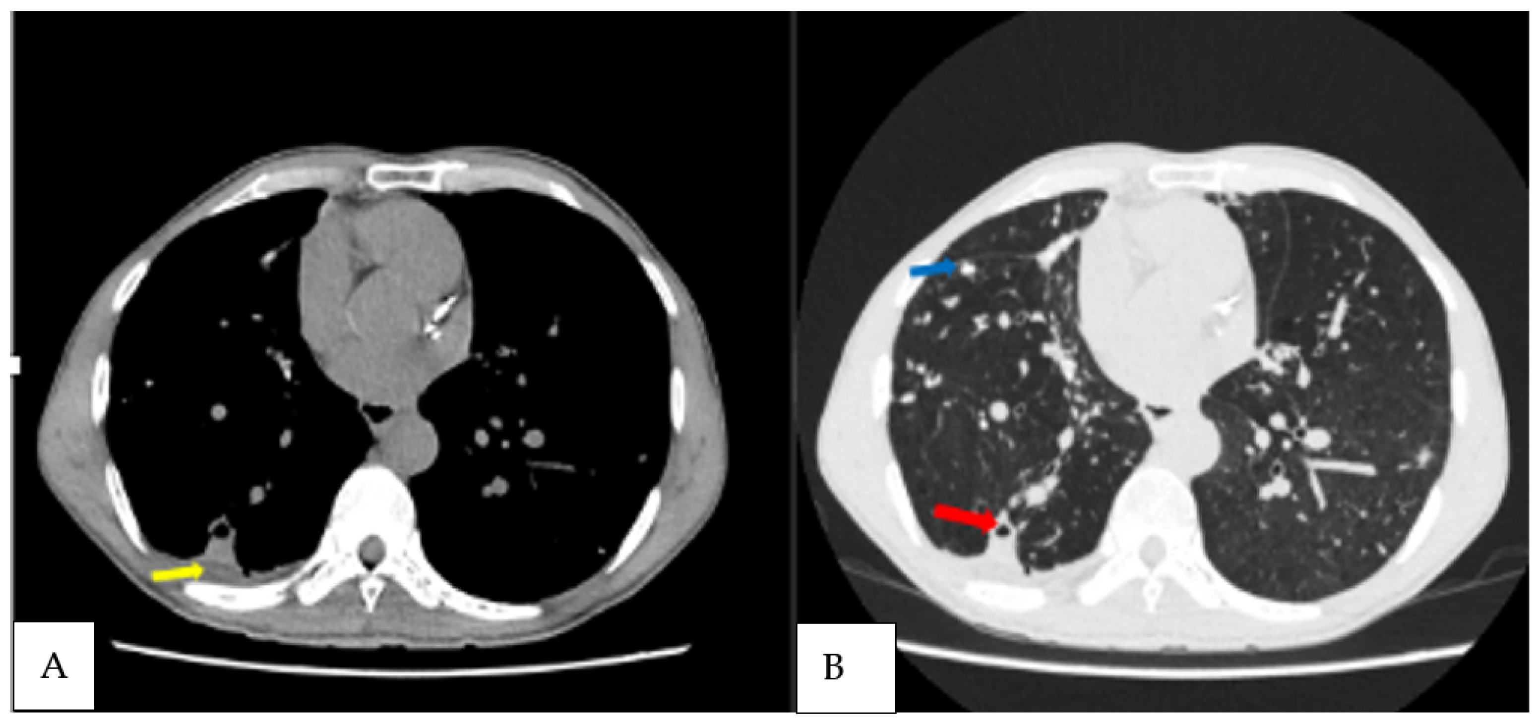 Jof 09 00026 g004 Jof 09 00026 g004