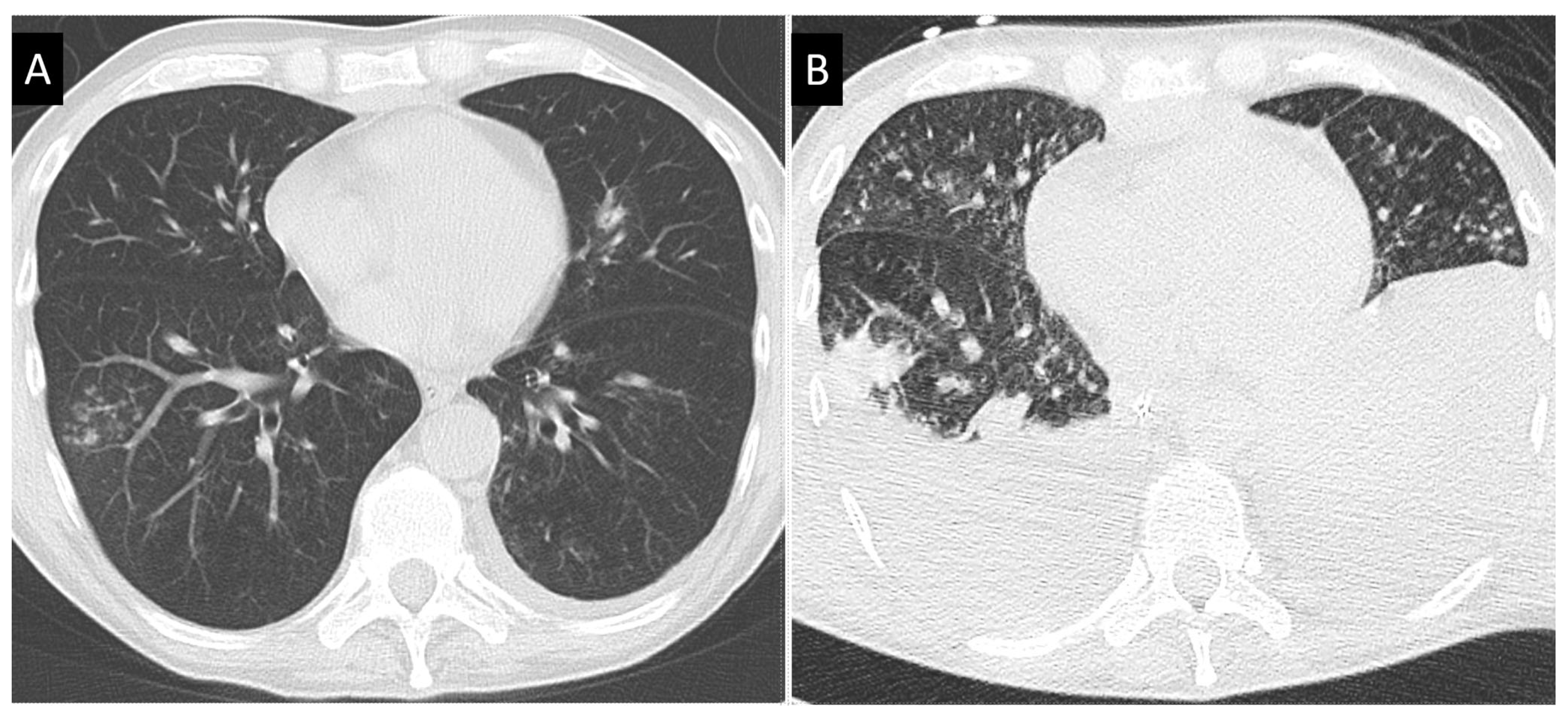 Jof 09 00131 g002 Jof 09 00131 g002