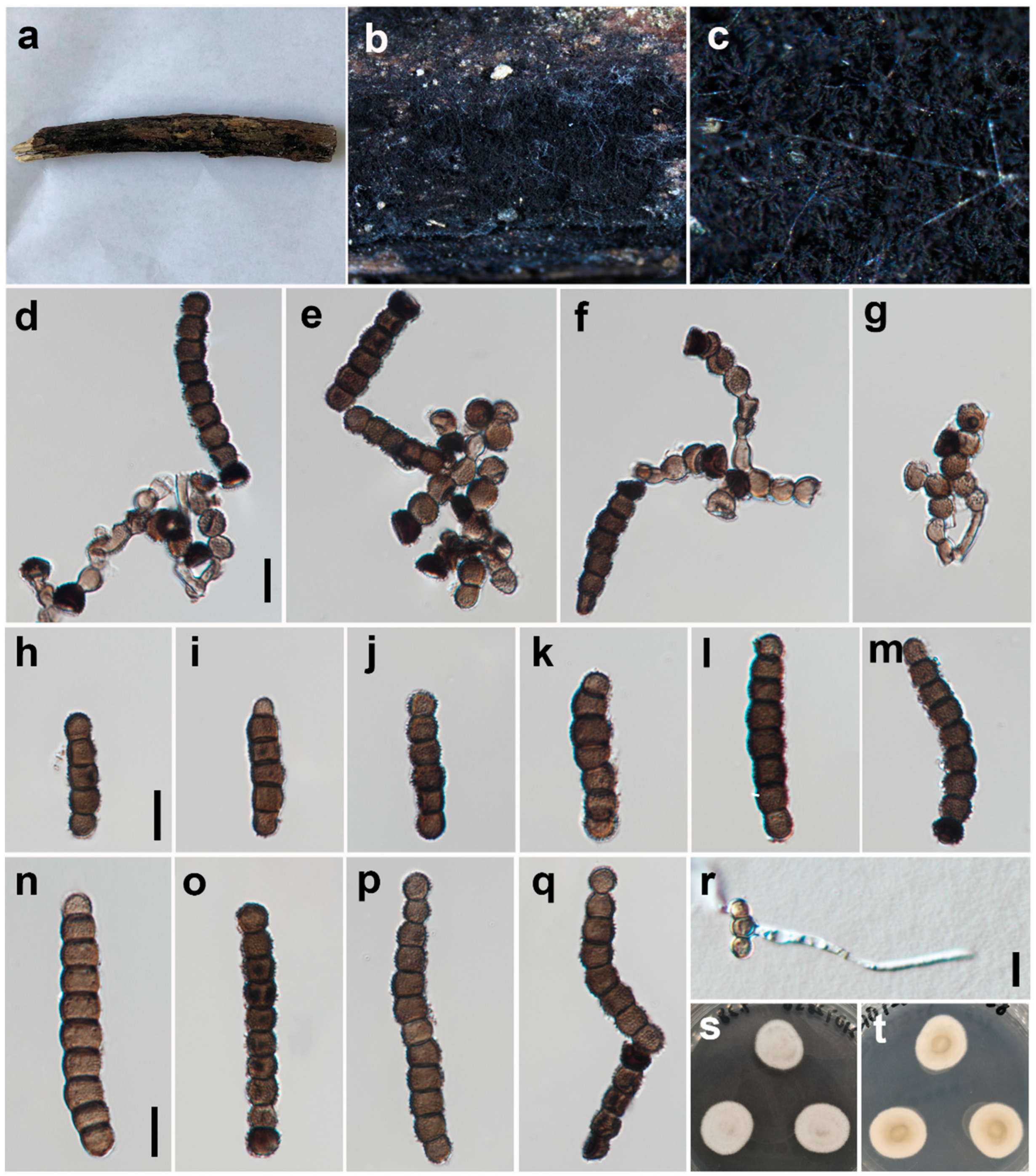 Jof 09 00150 g004 Jof 09 00150 g004