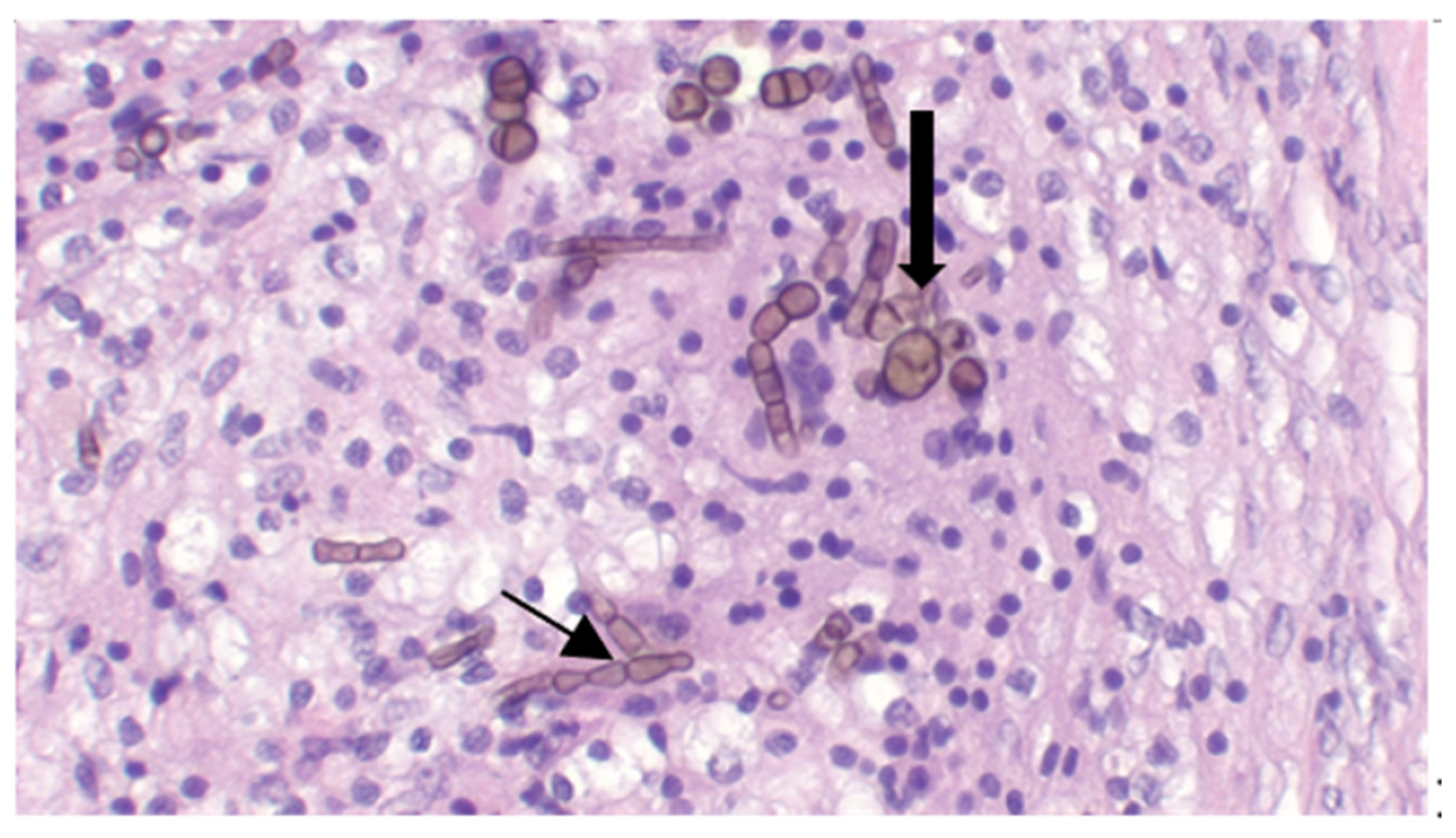 Jof 09 00191 g005 Jof 09 00191 g005