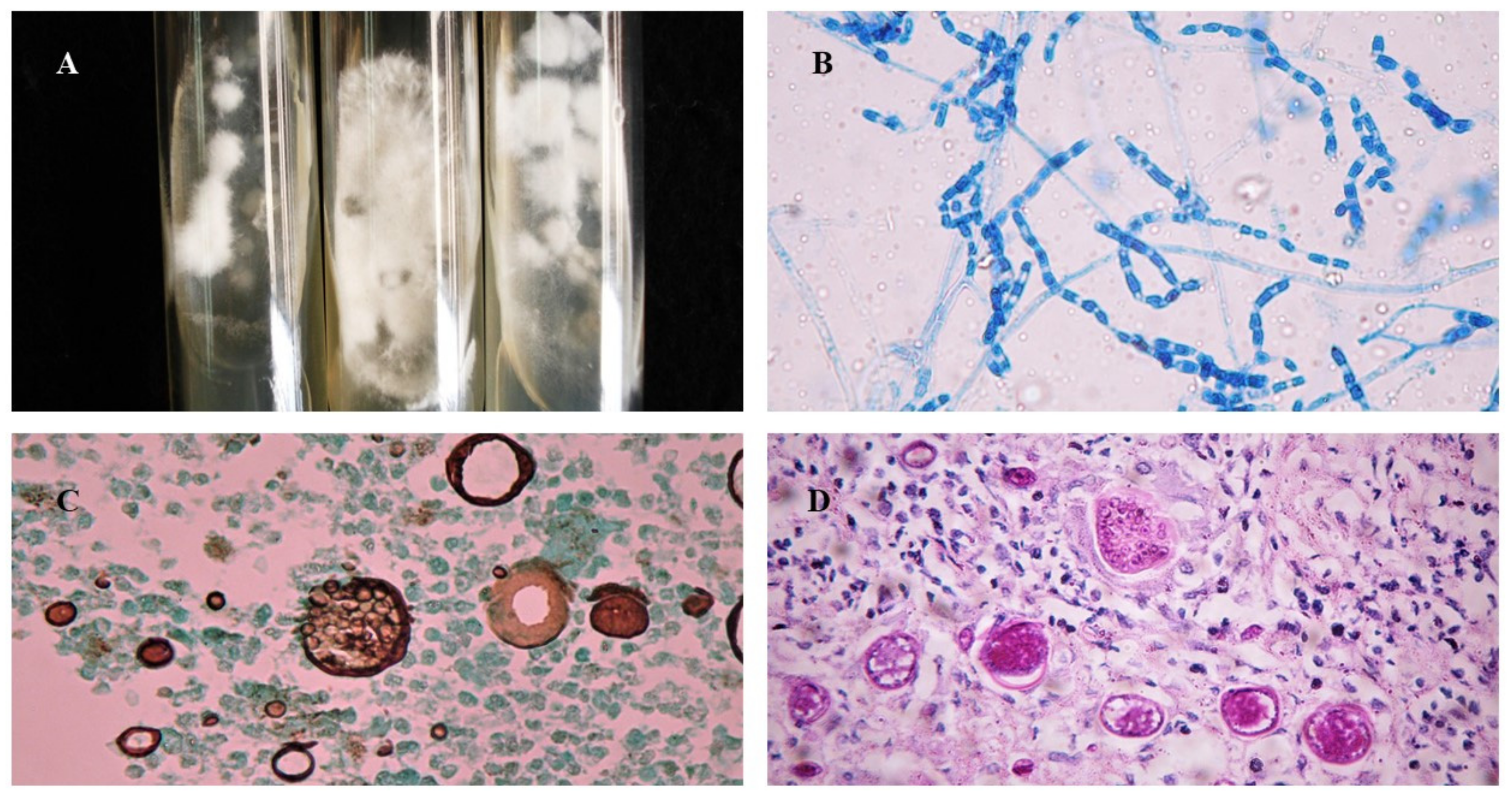 Jof 09 00218 g003 Jof 09 00218 g003