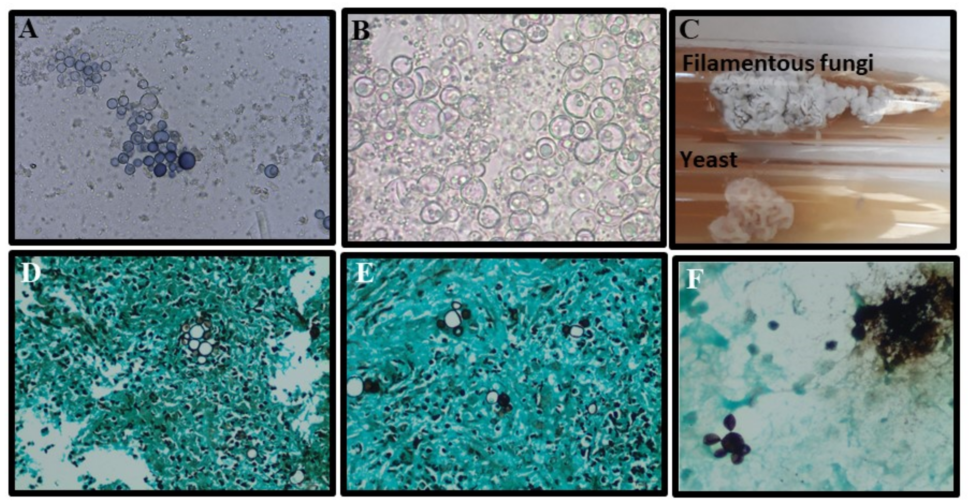 Jof 09 00218 g007 Jof 09 00218 g007