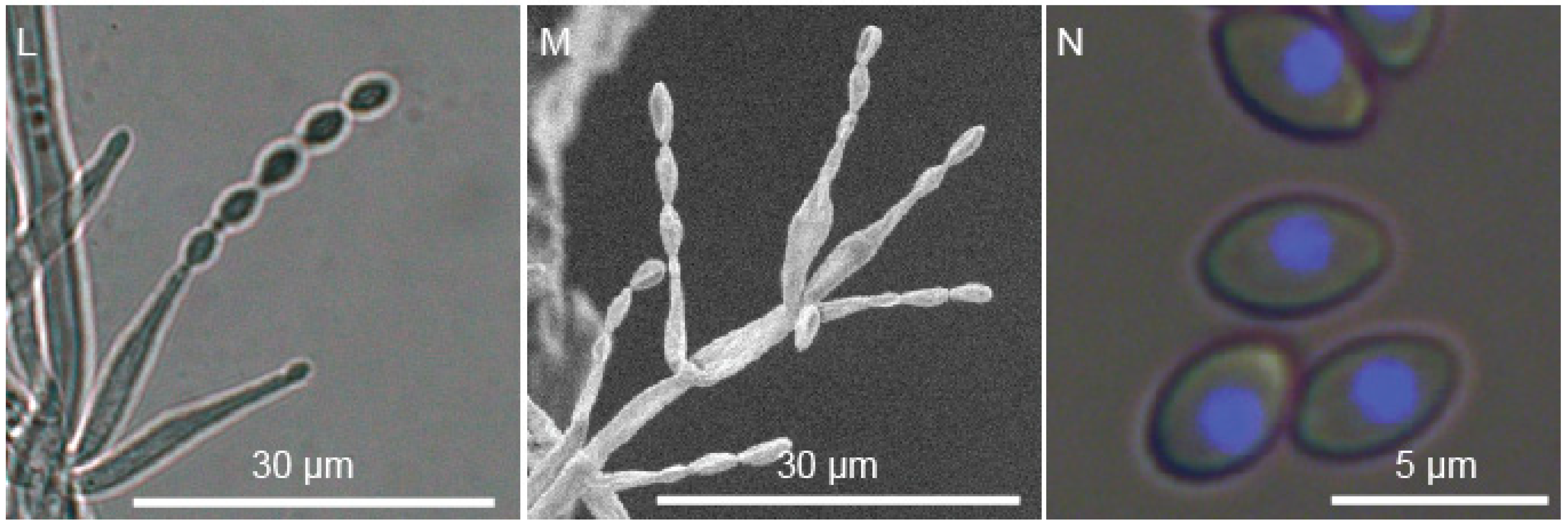 Jof 09 00285 g005b Jof 09 00285 g005b