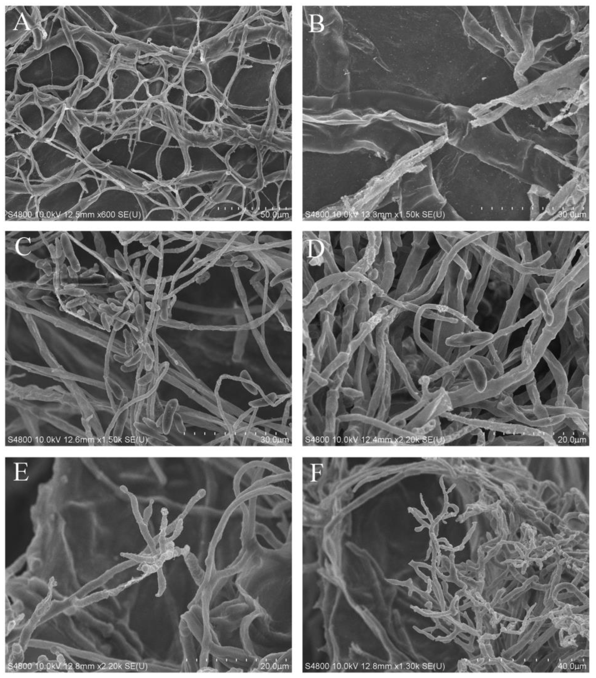 Jof 09 00304 g006 Jof 09 00304 g006