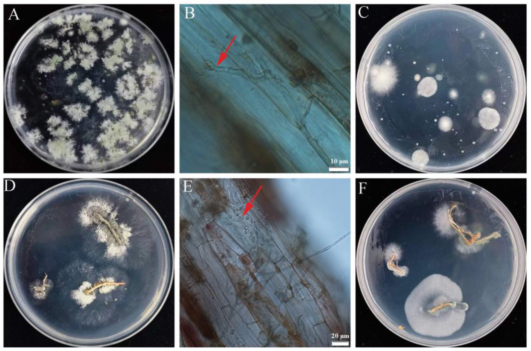 Jof 09 00304 g011 Jof 09 00304 g011