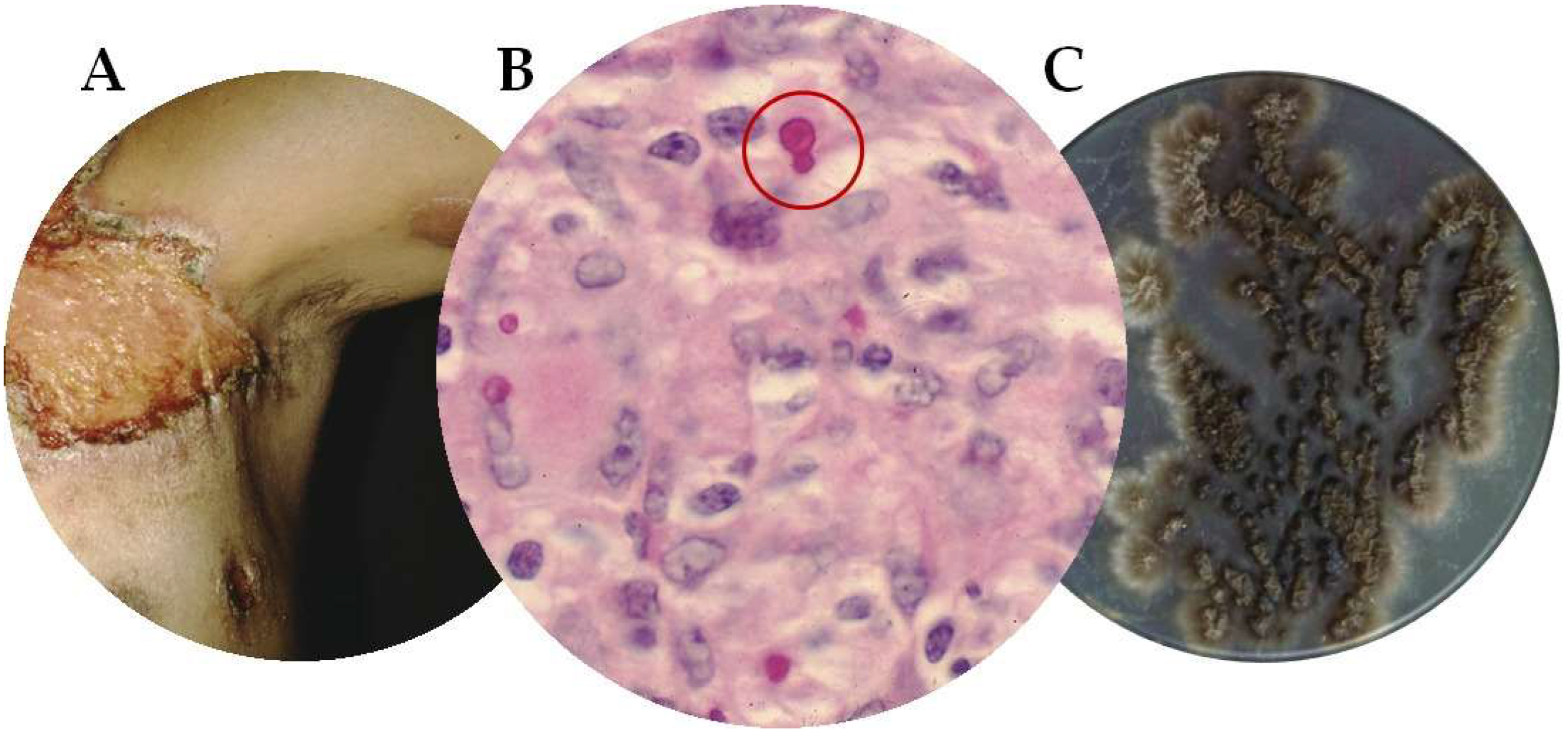 Jof 09 00396 g001 Jof 09 00396 g001