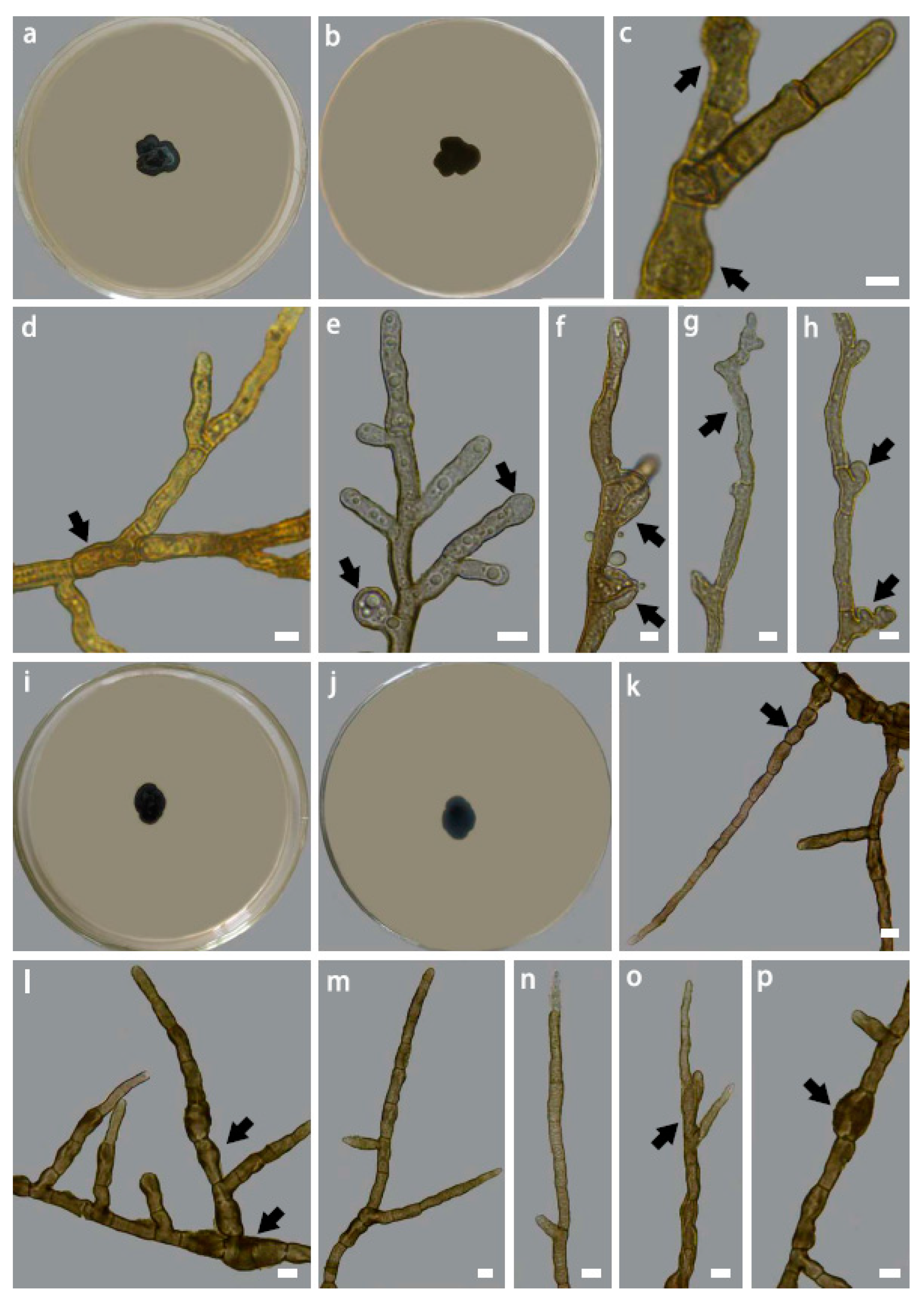 Jof 09 00423 g004 Jof 09 00423 g004