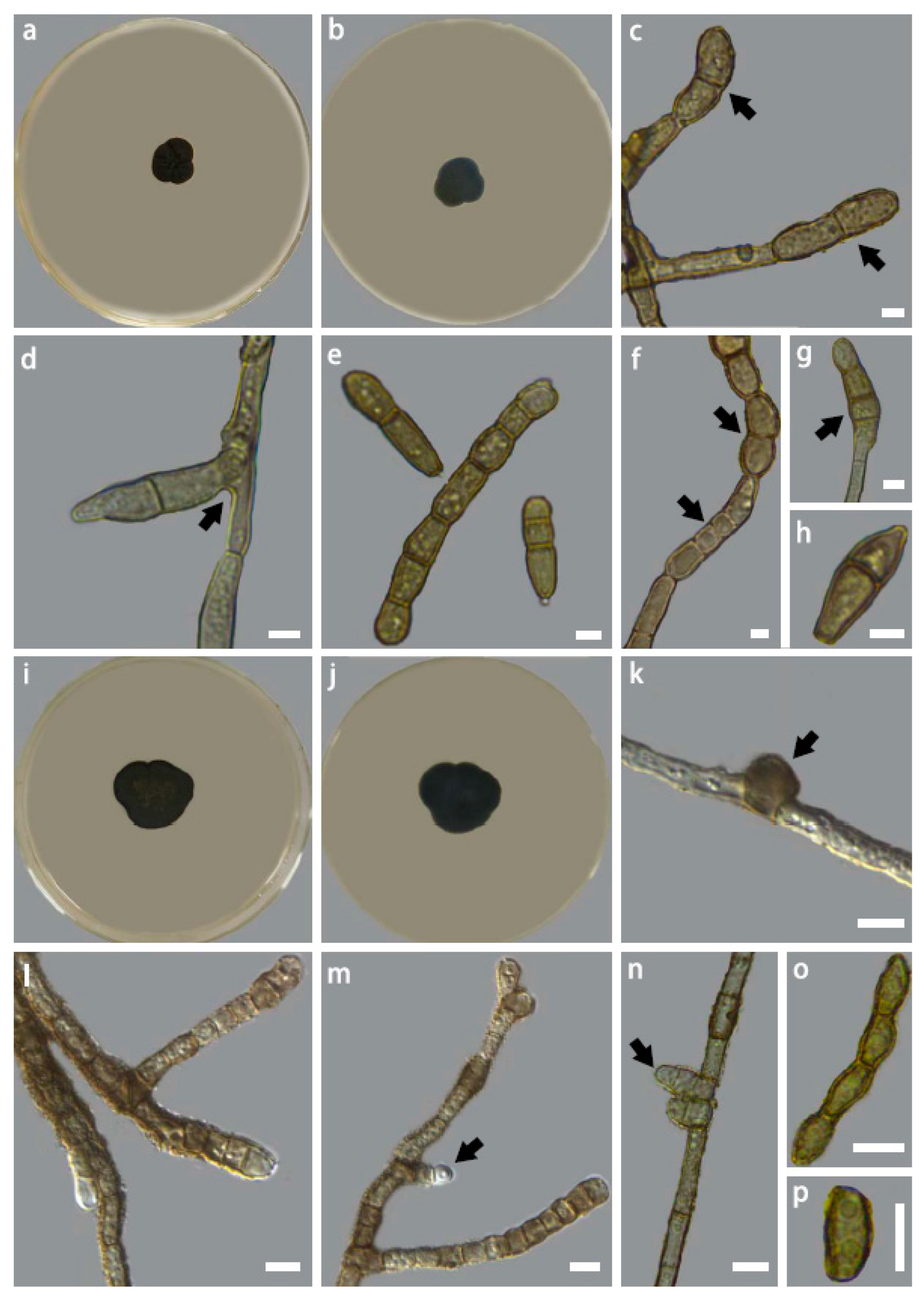 Jof 09 00423 g005 Jof 09 00423 g005