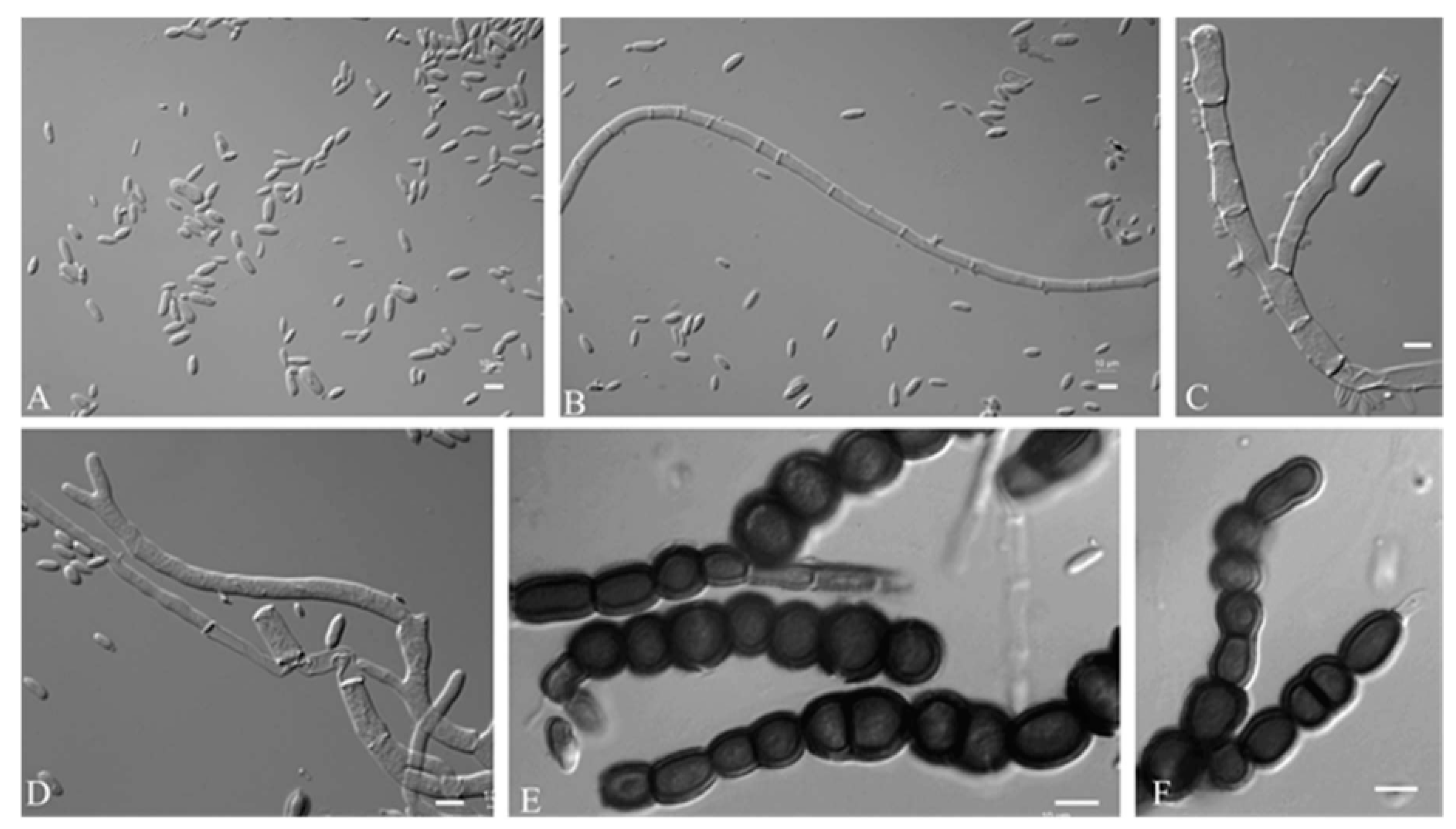 Jof 09 00447 g005 Jof 09 00447 g005