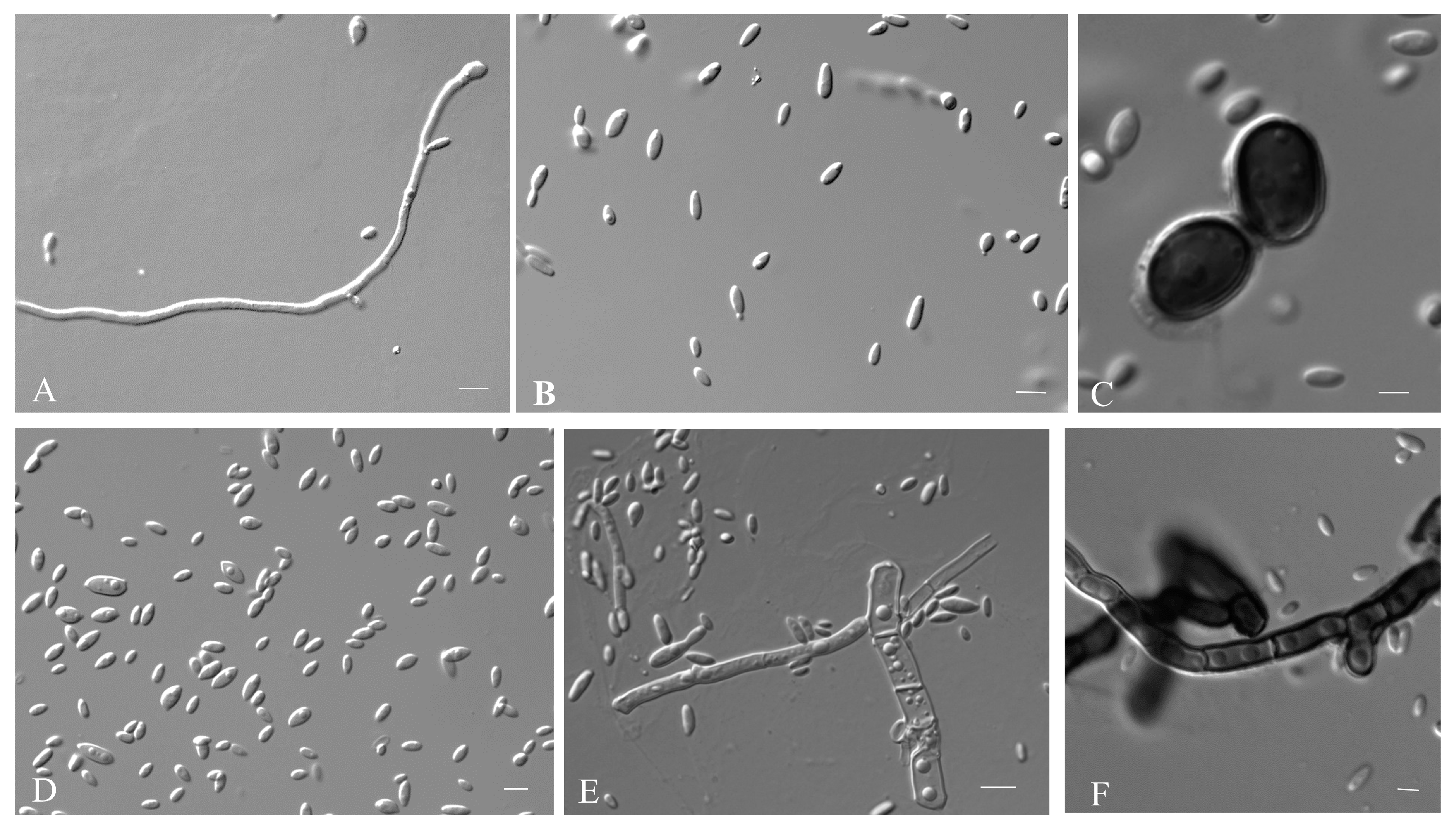 zo−３ GRU-Based Denoising Autoencoder for Detection and Clustering