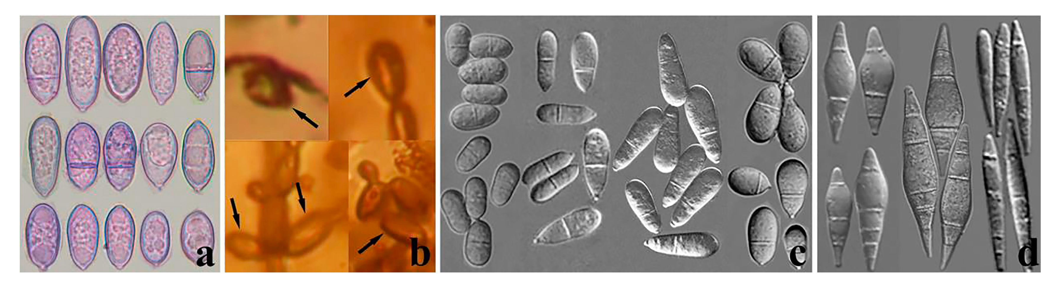 Jof 09 00451 g005 Jof 09 00451 g005