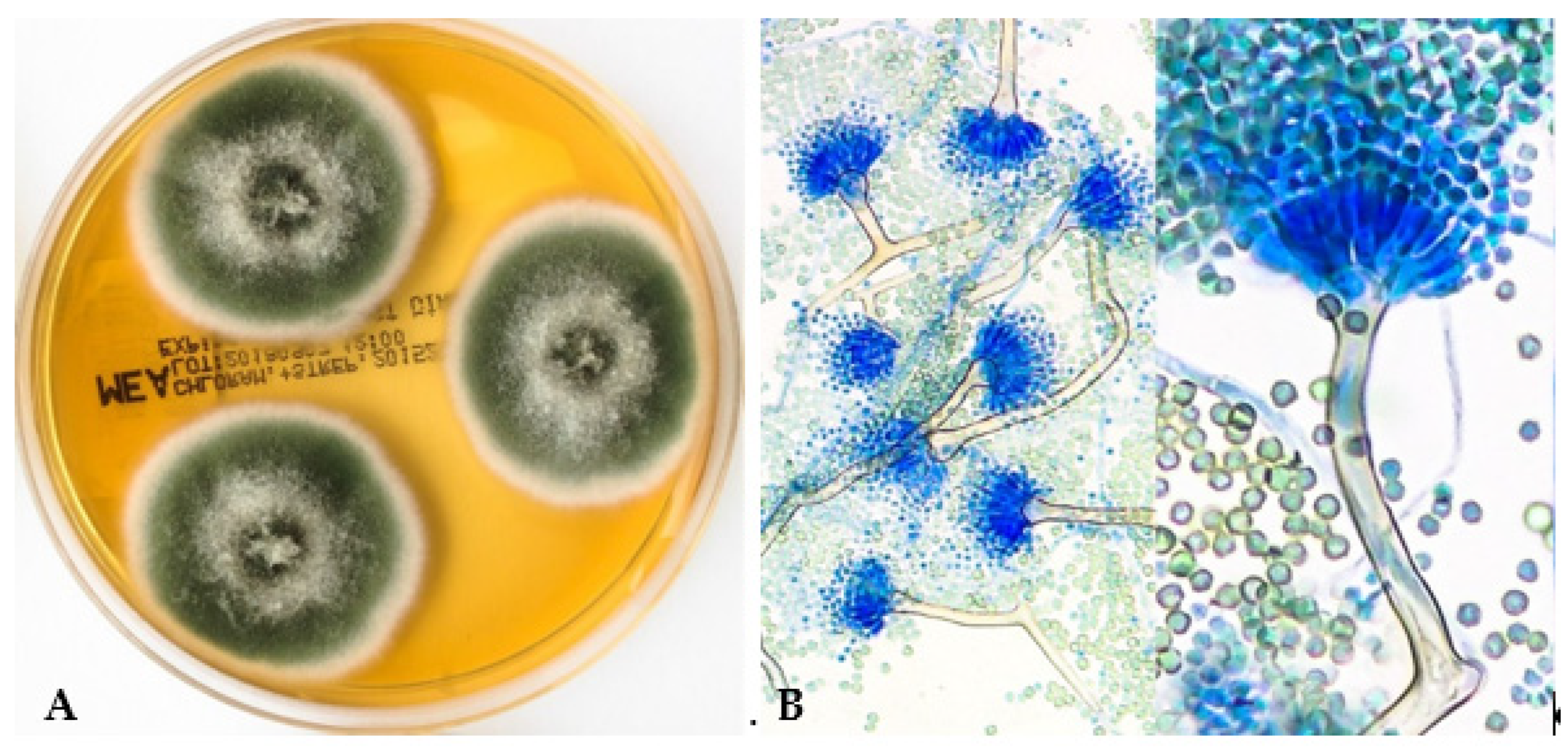 Aspergillus Microscopic