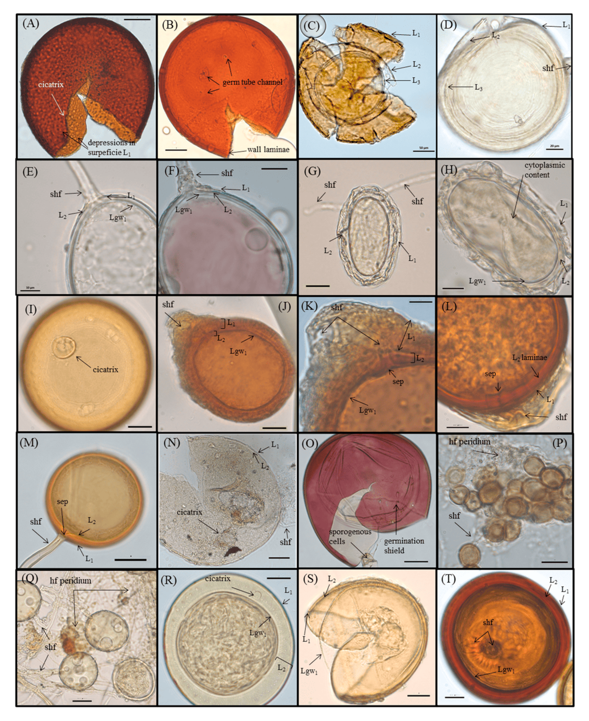 Jof 09 00540 g004 Jof 09 00540 g004