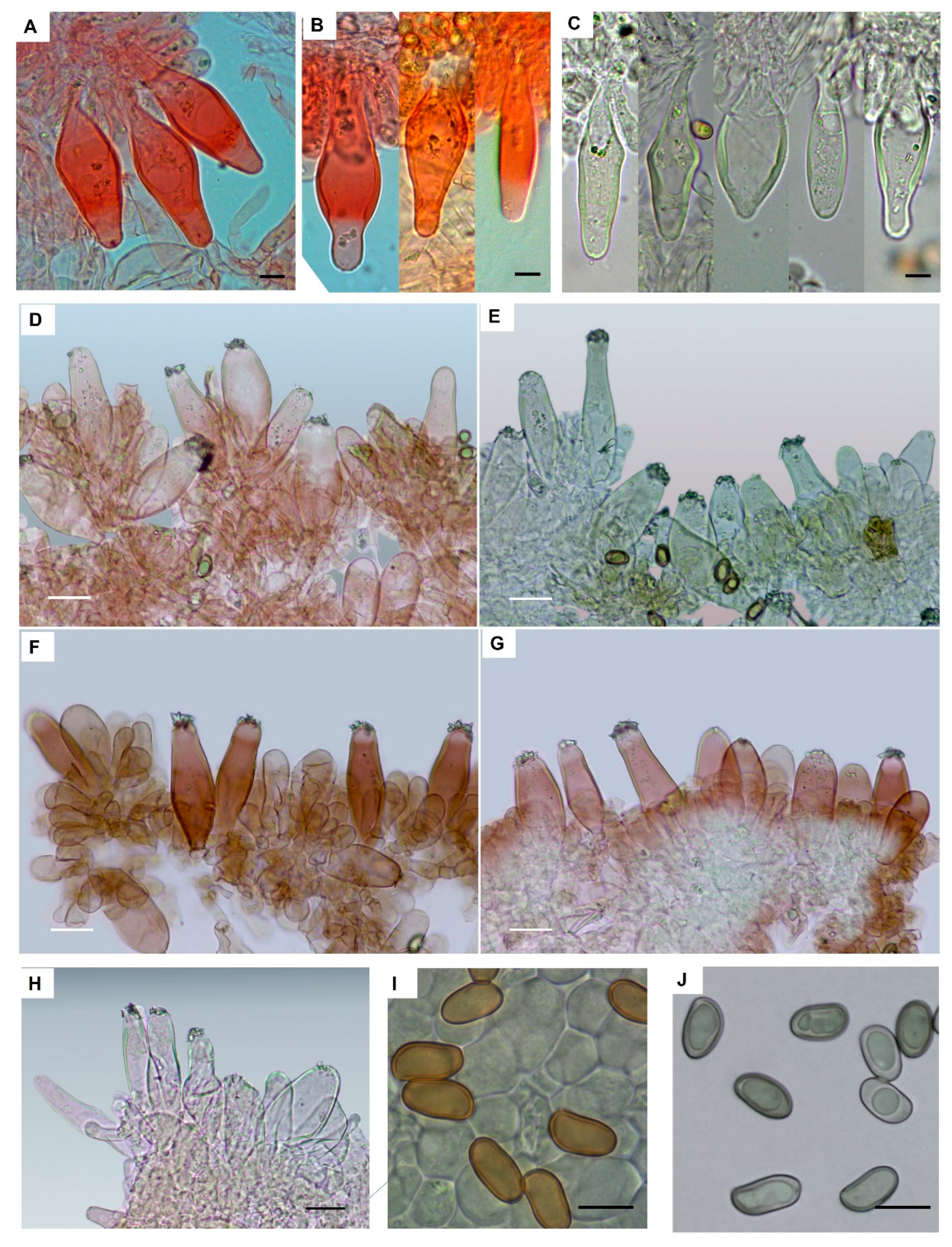 Jof 09 00679 g004 Jof 09 00679 g004