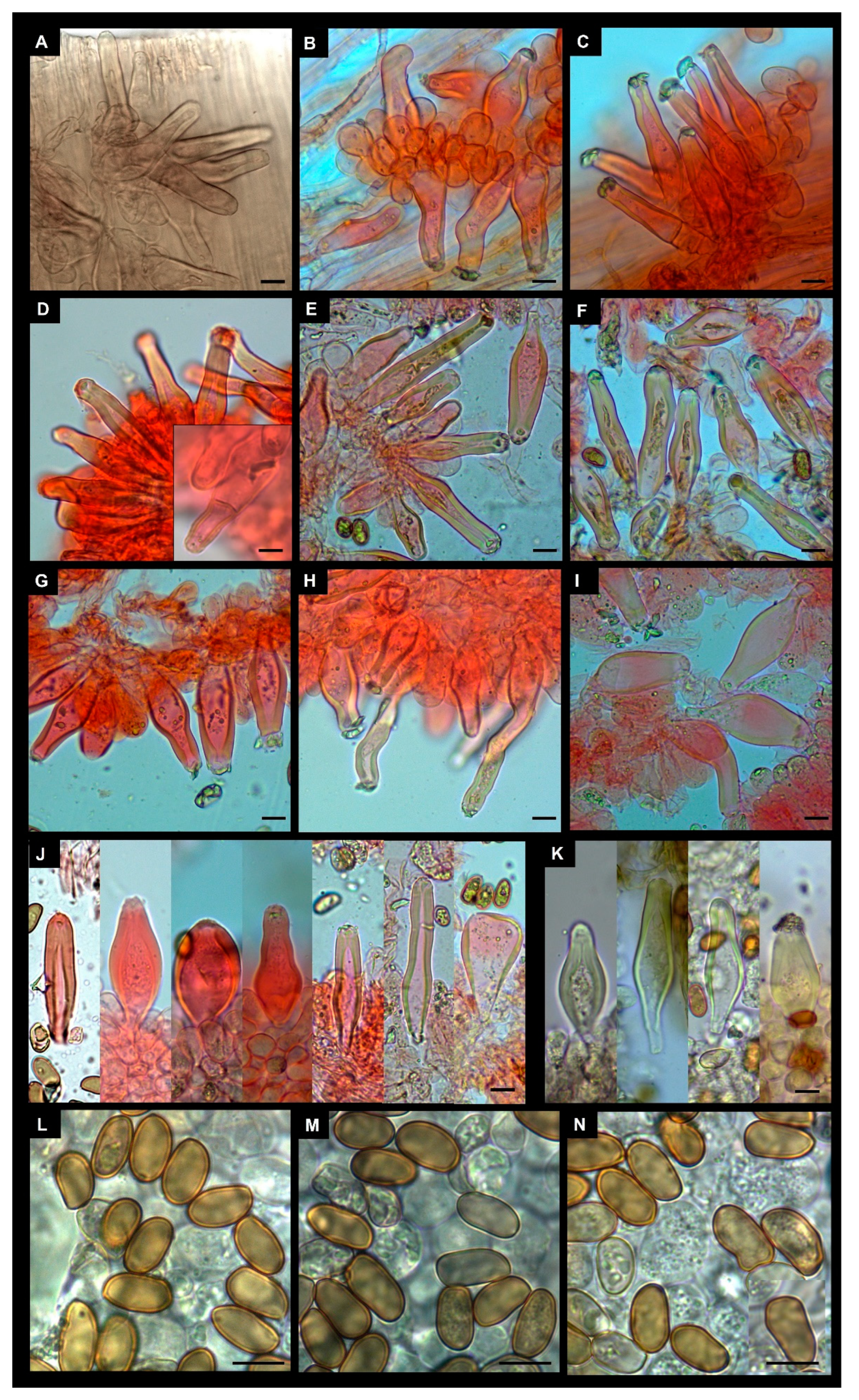 Jof 09 00679 g007 Jof 09 00679 g007