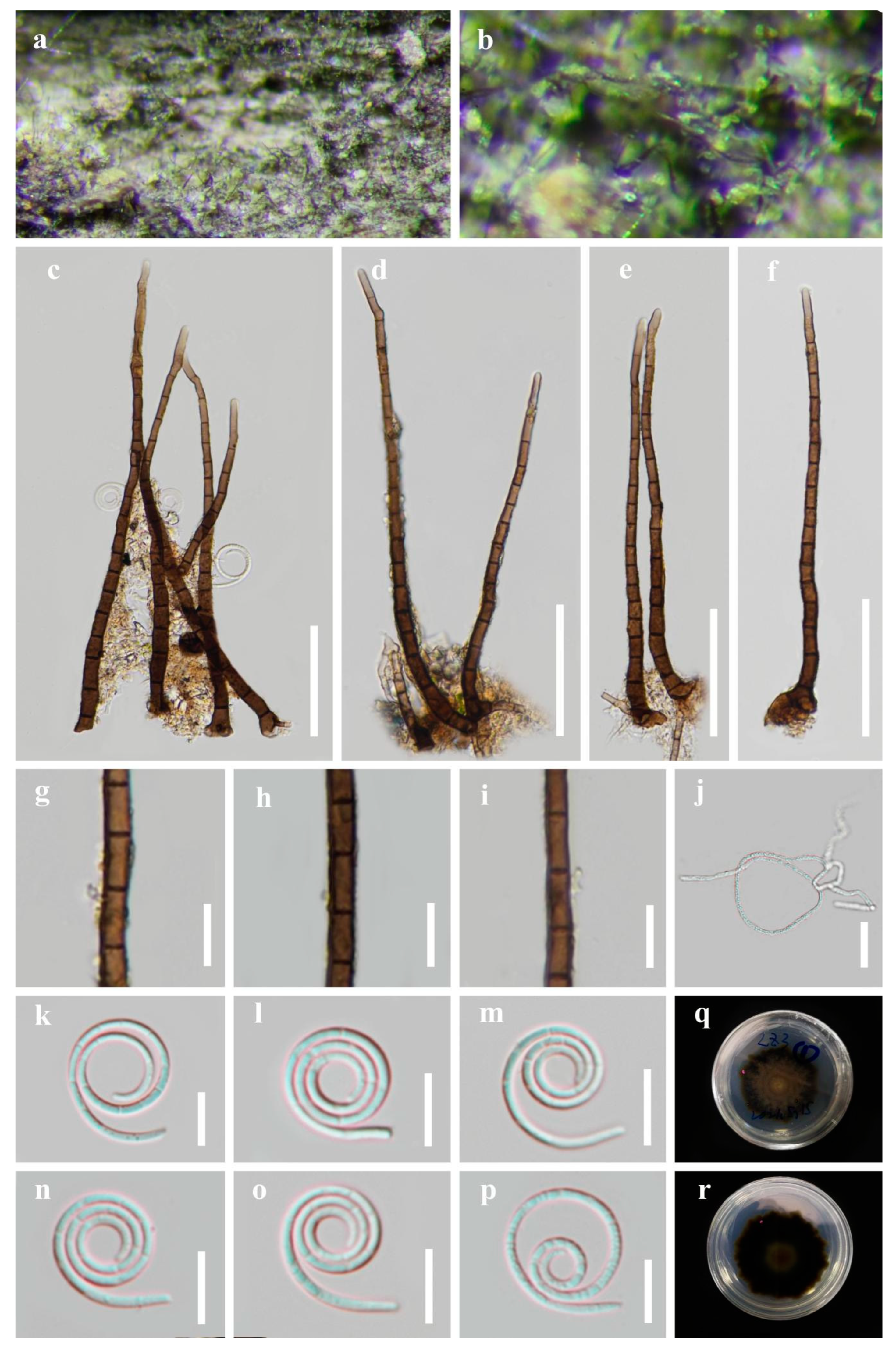 Jof 09 00775 g004 Jof 09 00775 g004