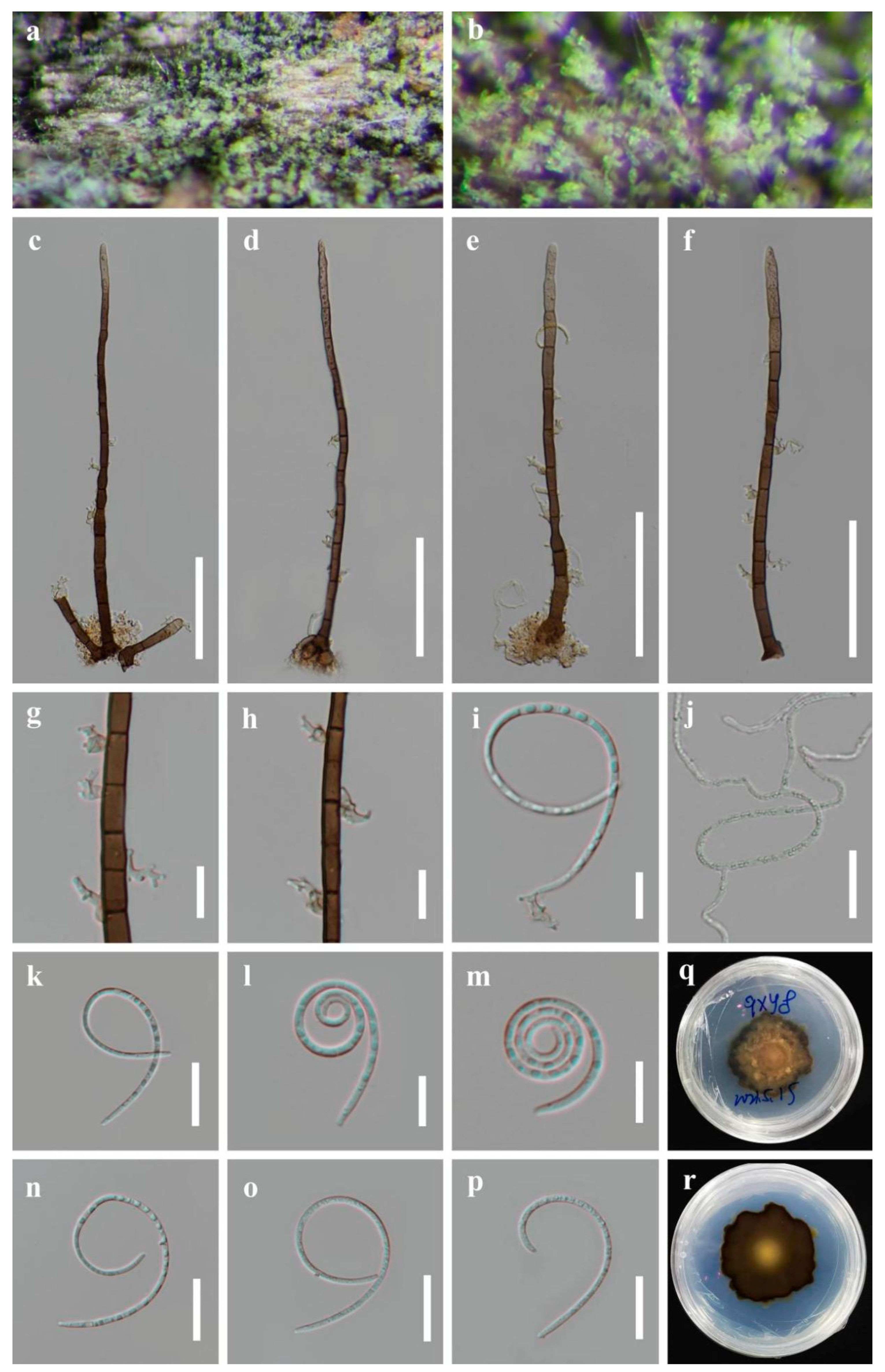 Jof 09 00775 g005 Jof 09 00775 g005
