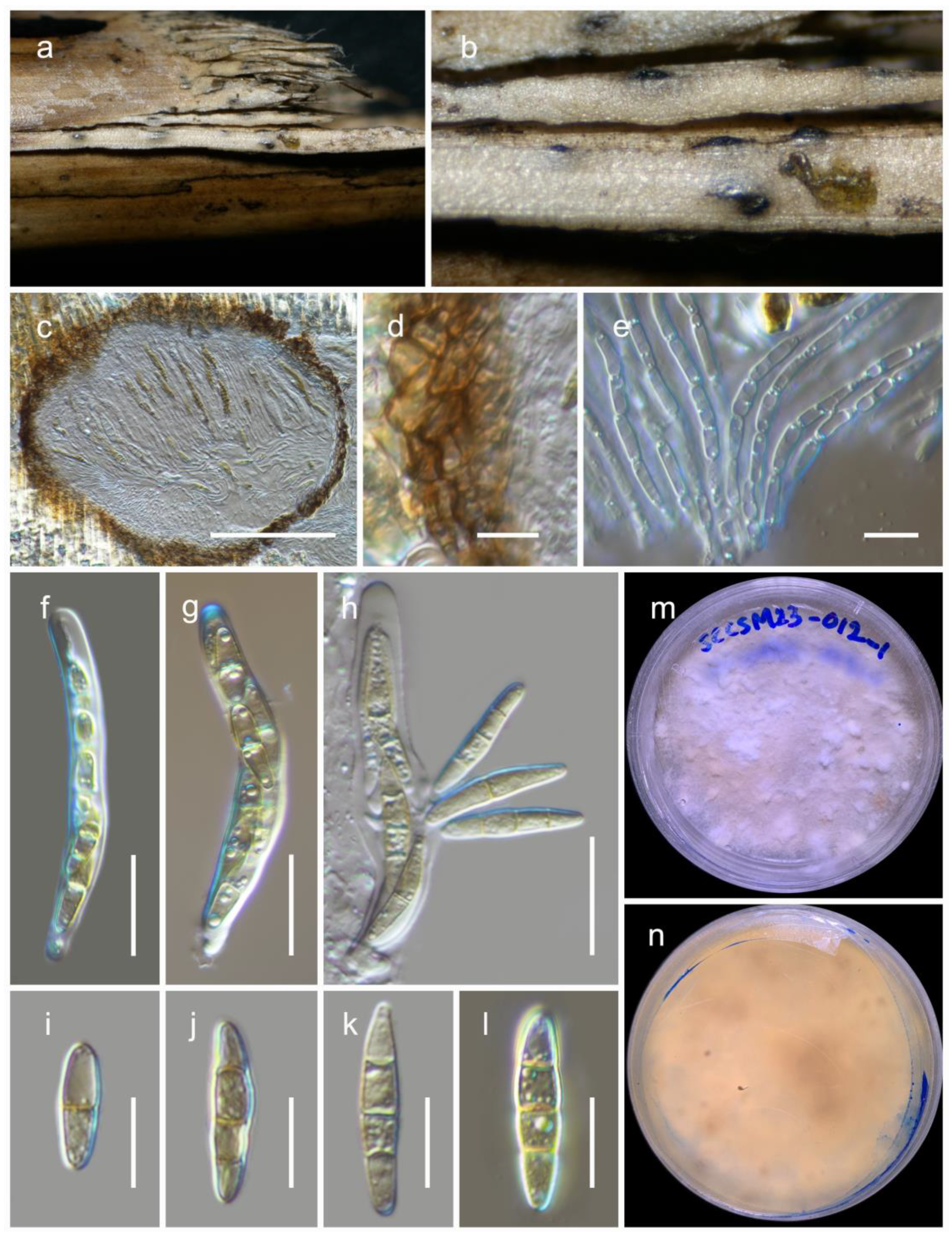 Jof 09 00853 g004 Jof 09 00853 g004