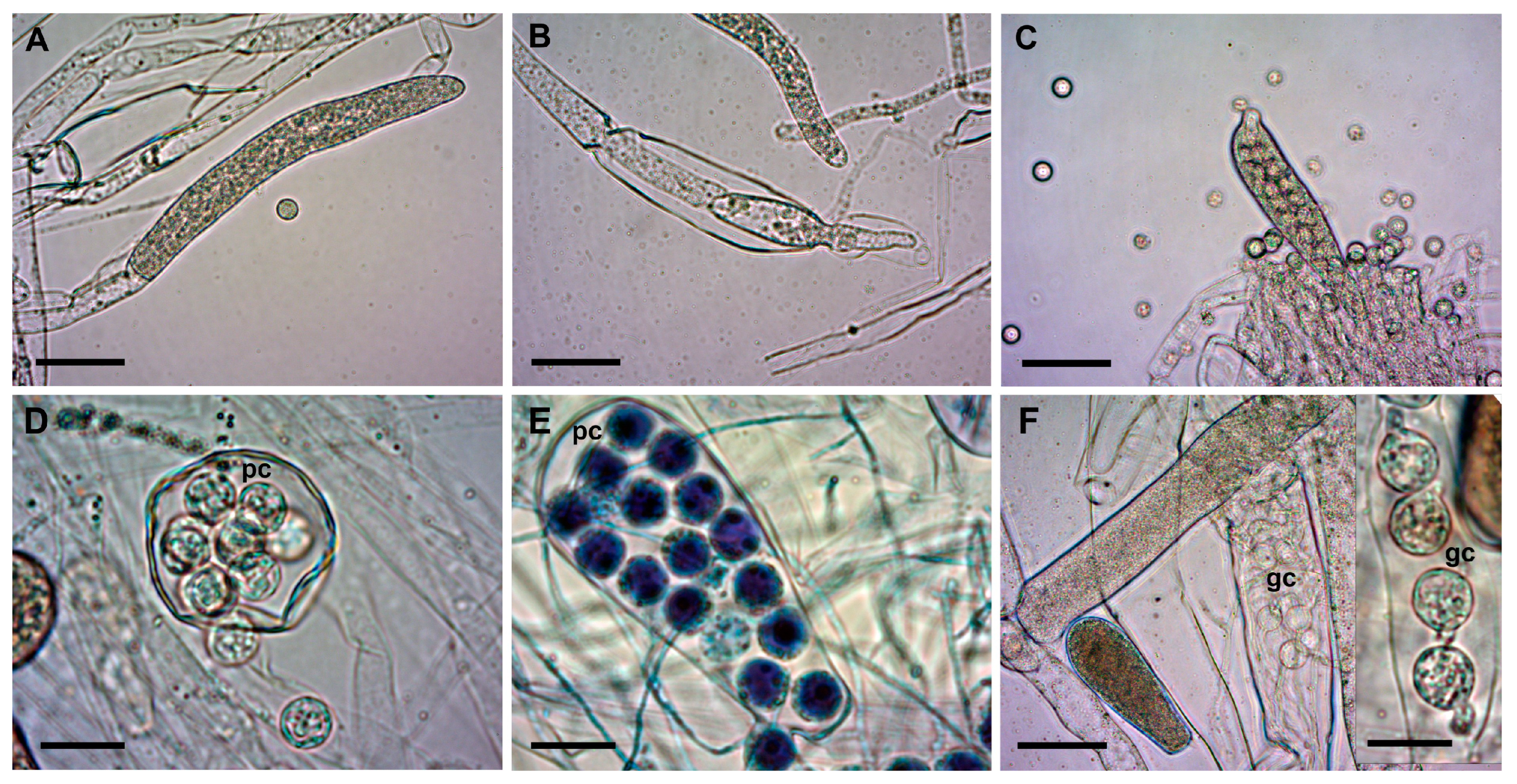 Jof 09 00982 g003 Jof 09 00982 g003