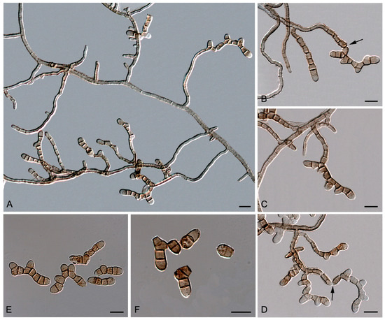 Diversity of Rock-Inhabiting Fungi in Tarragona Province, Spain