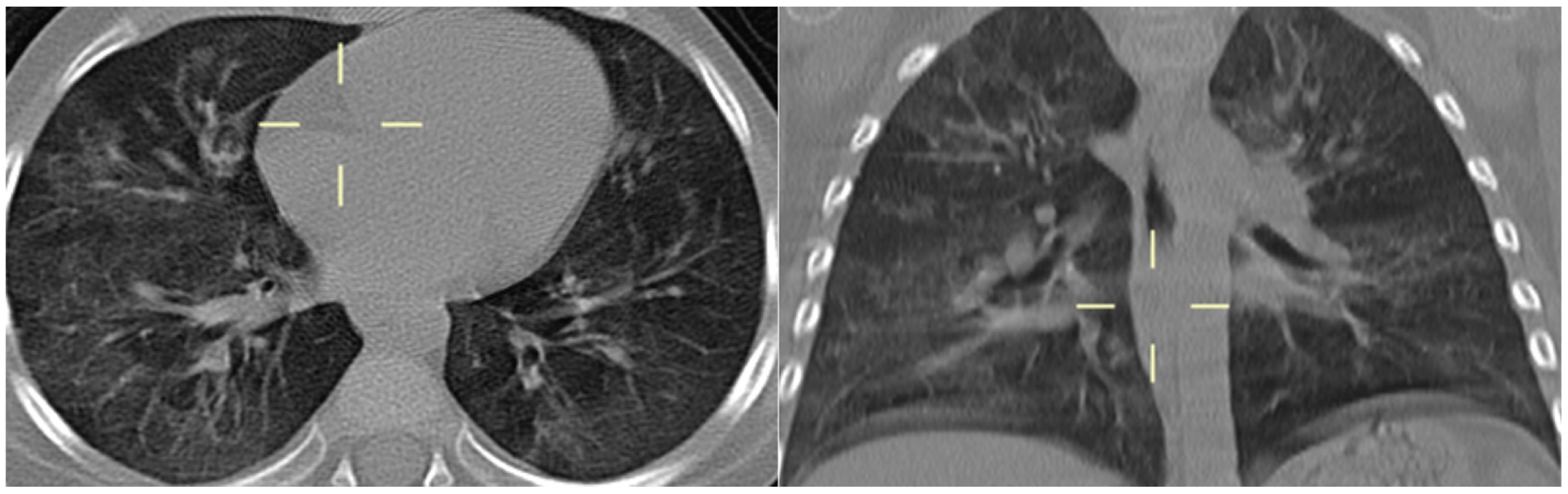 Jof 10 00276 g004 Jof 10 00276 g004