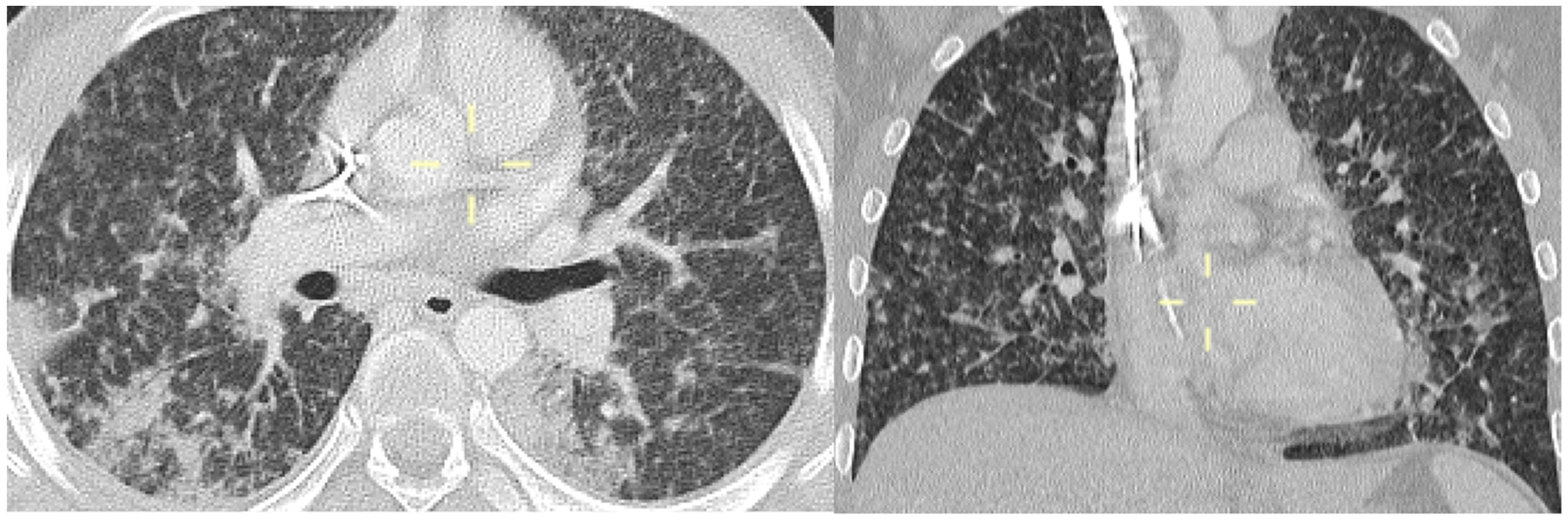 Jof 10 00276 g005 Jof 10 00276 g005