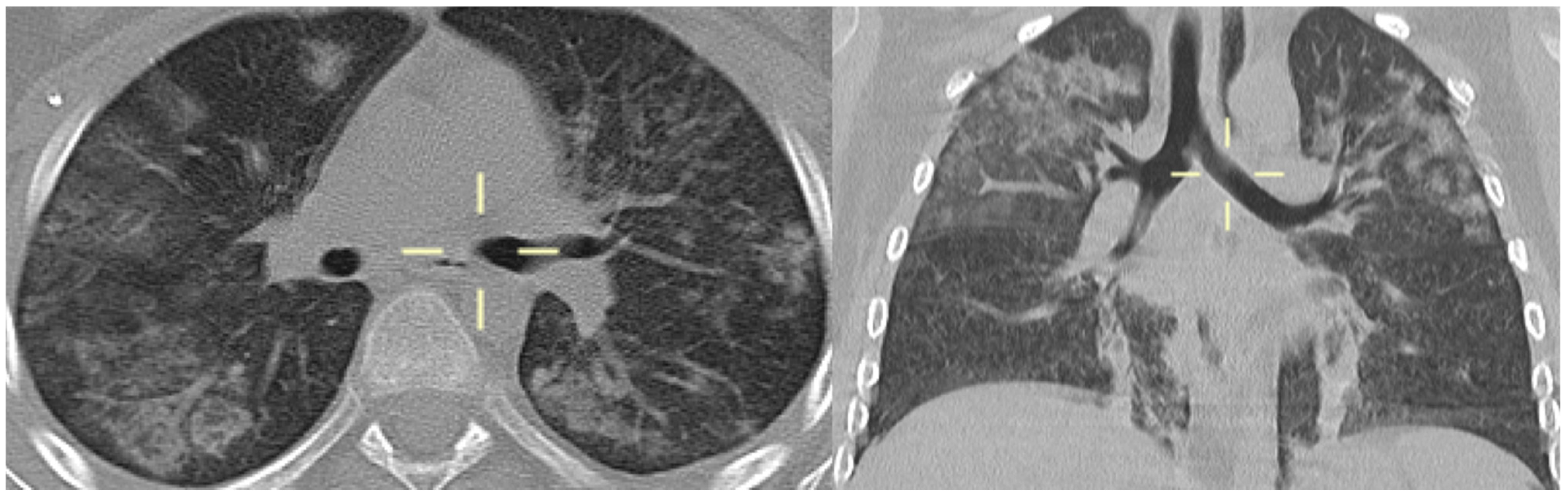 Jof 10 00276 g006 Jof 10 00276 g006