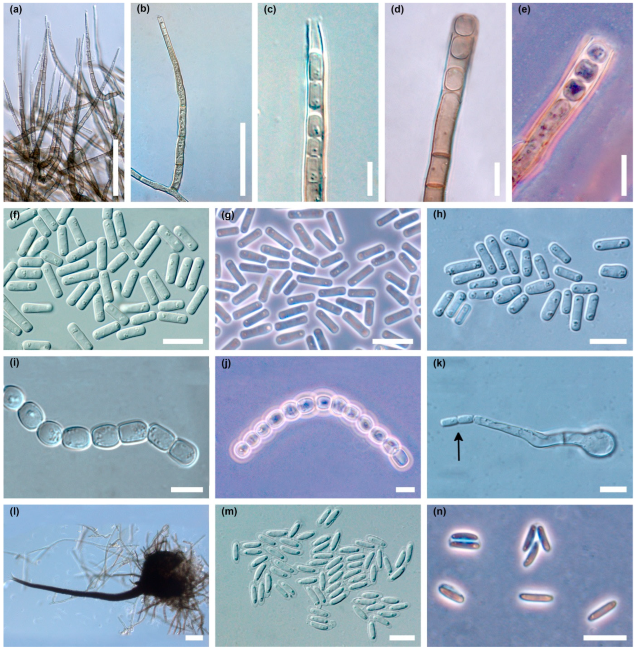 Jof 10 00465 g004 Jof 10 00465 g004