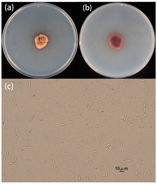 Whole-Genome Sequencing and Genome Annotation of Pathogenic