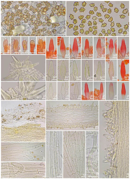 Contributions to the Inocybe umbratica–paludinella