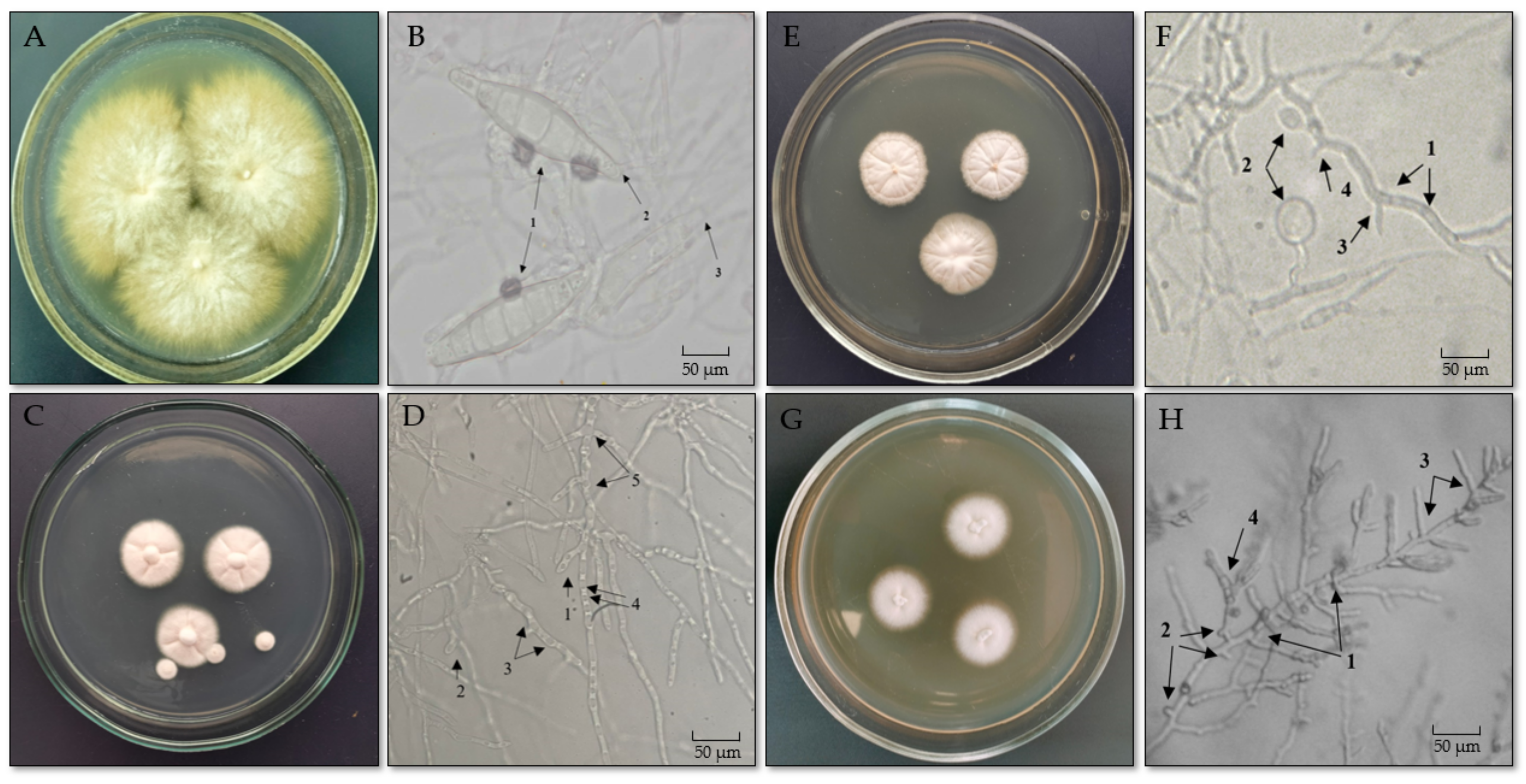 Jof 11 00065 g002 Jof 11 00065 g002