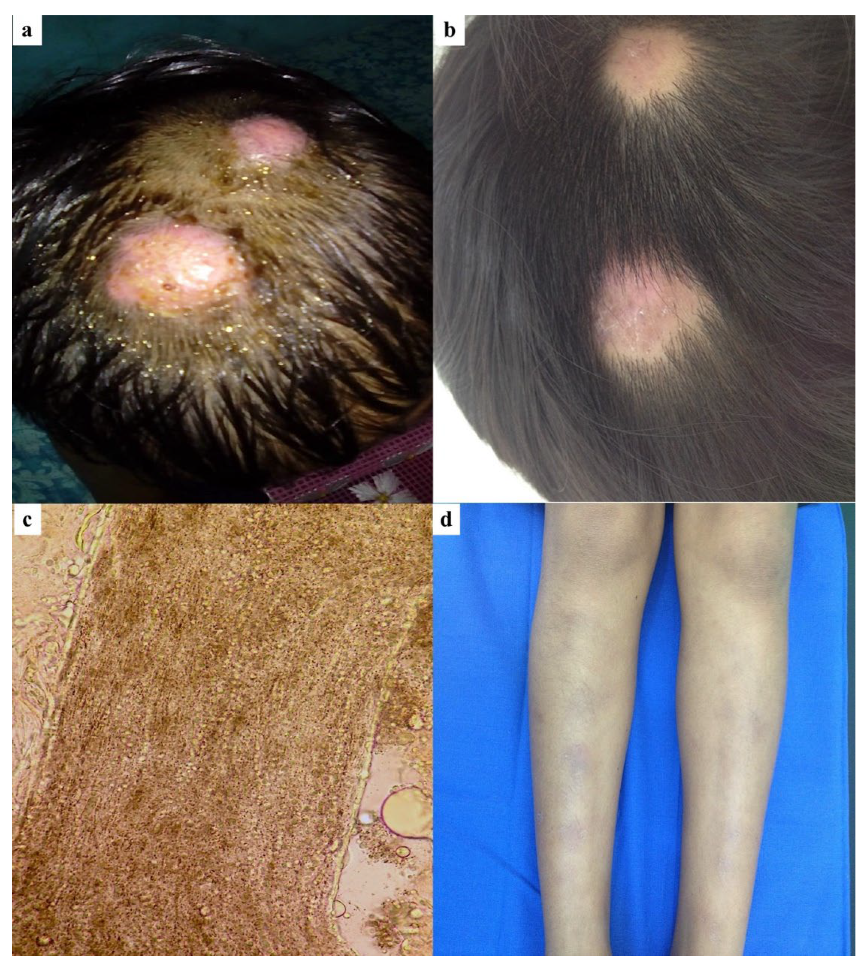 Jof 11 00103 g002 Jof 11 00103 g002