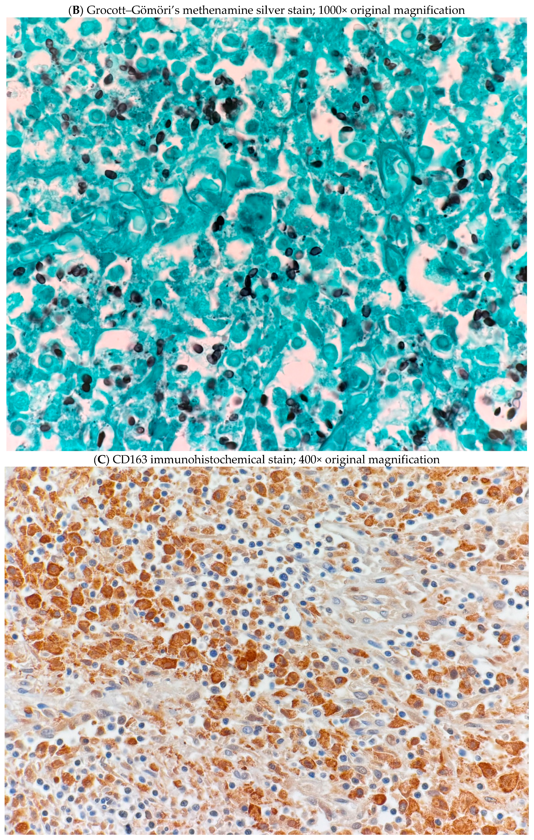 Jof 11 00201 g001b Jof 11 00201 g001b