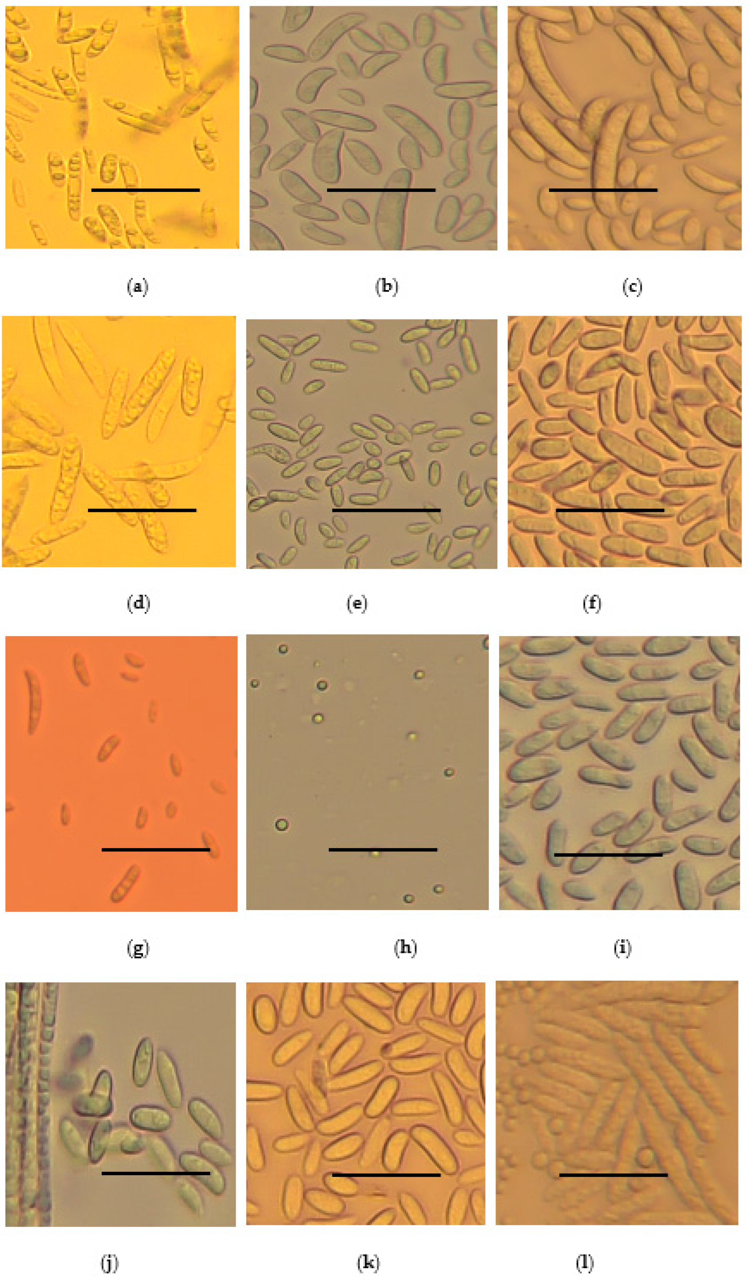 Jof 11 00283 g004 Jof 11 00283 g004