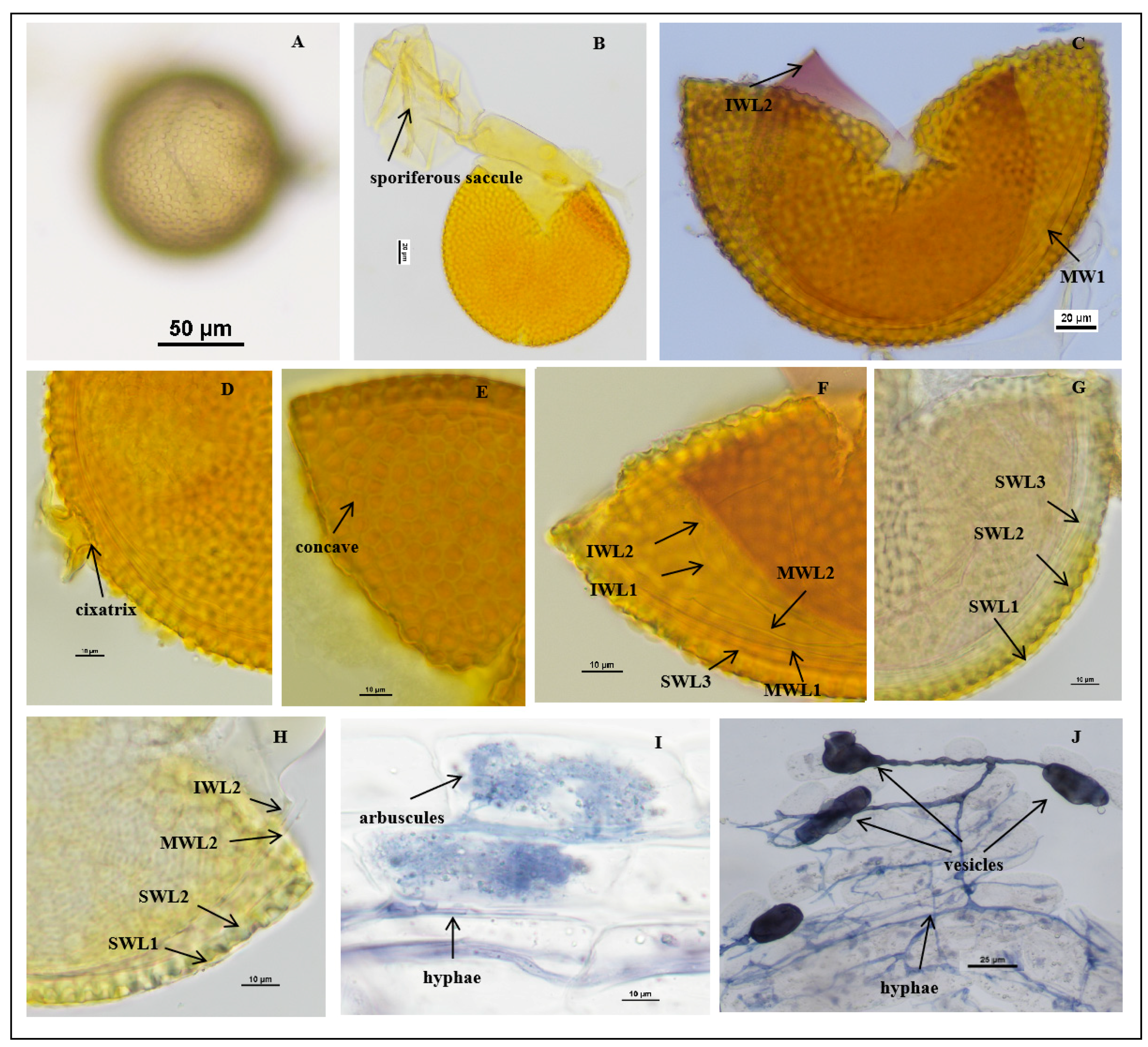 Jof 11 00382 g003 Jof 11 00382 g003