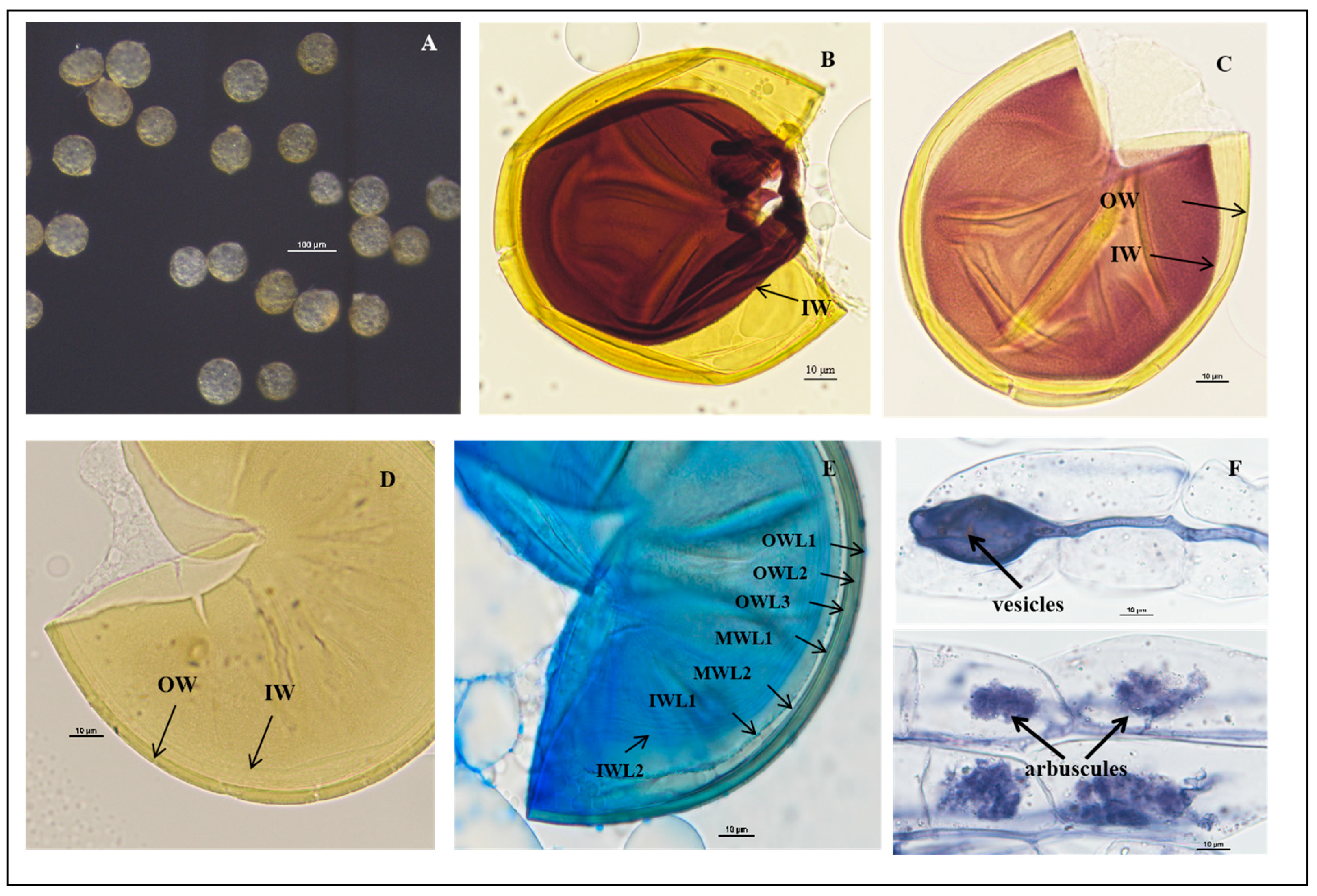 Jof 11 00382 g004 Jof 11 00382 g004