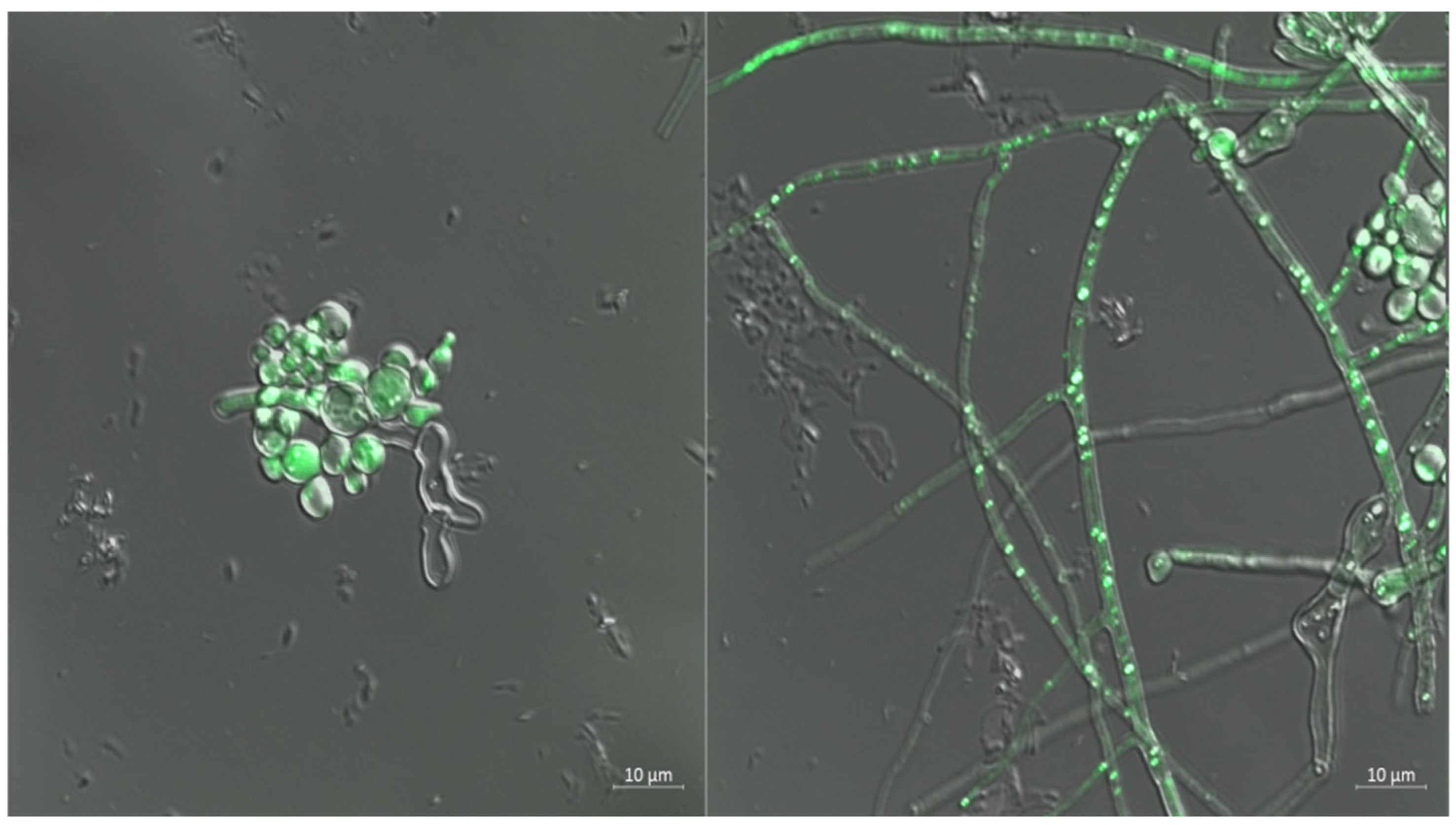 Jof 11 00386 g006 Jof 11 00386 g006