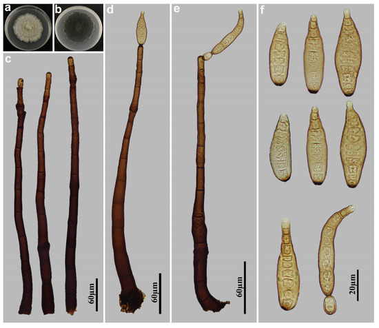 Six Novel Species of Distoseptispora (Distoseptisporaceae